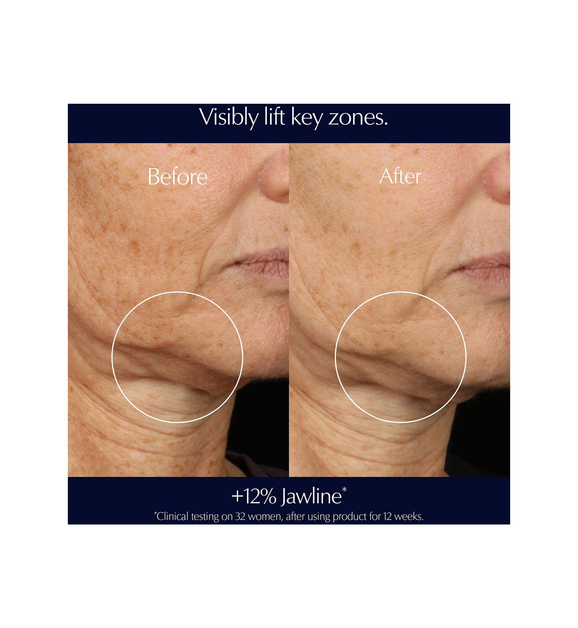 Perfectionist Pro Rapid Firm + Lift Serum with Hexapeptides