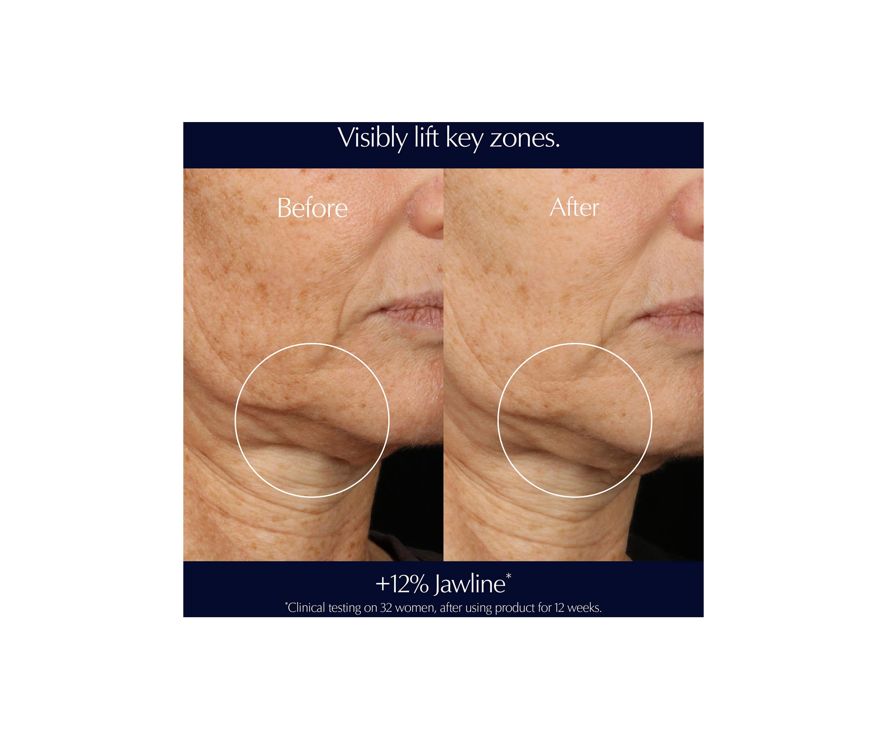 Perfectionist Pro Rapid Firm + Lift Serum with Hexapeptides