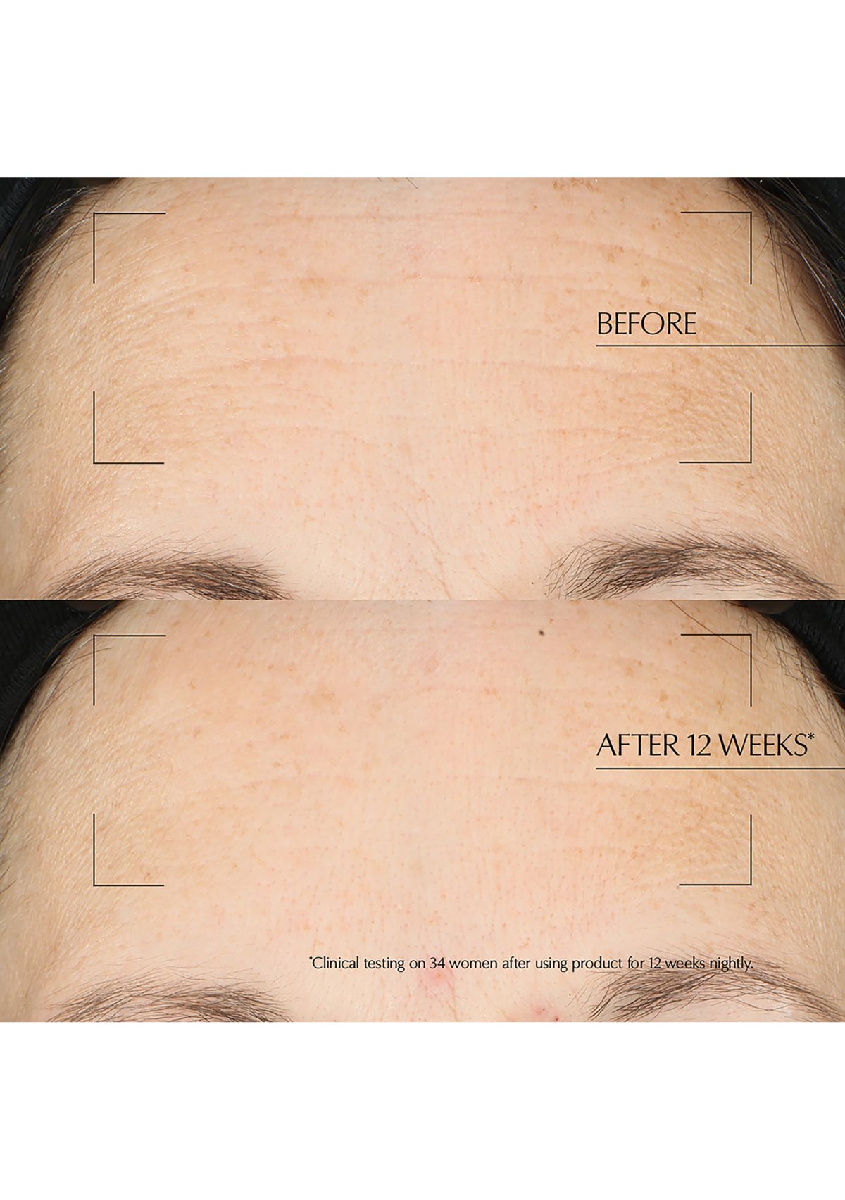 Advanced Night Repair Moisturizing Overnight Treatment with Hyaluronic Acid