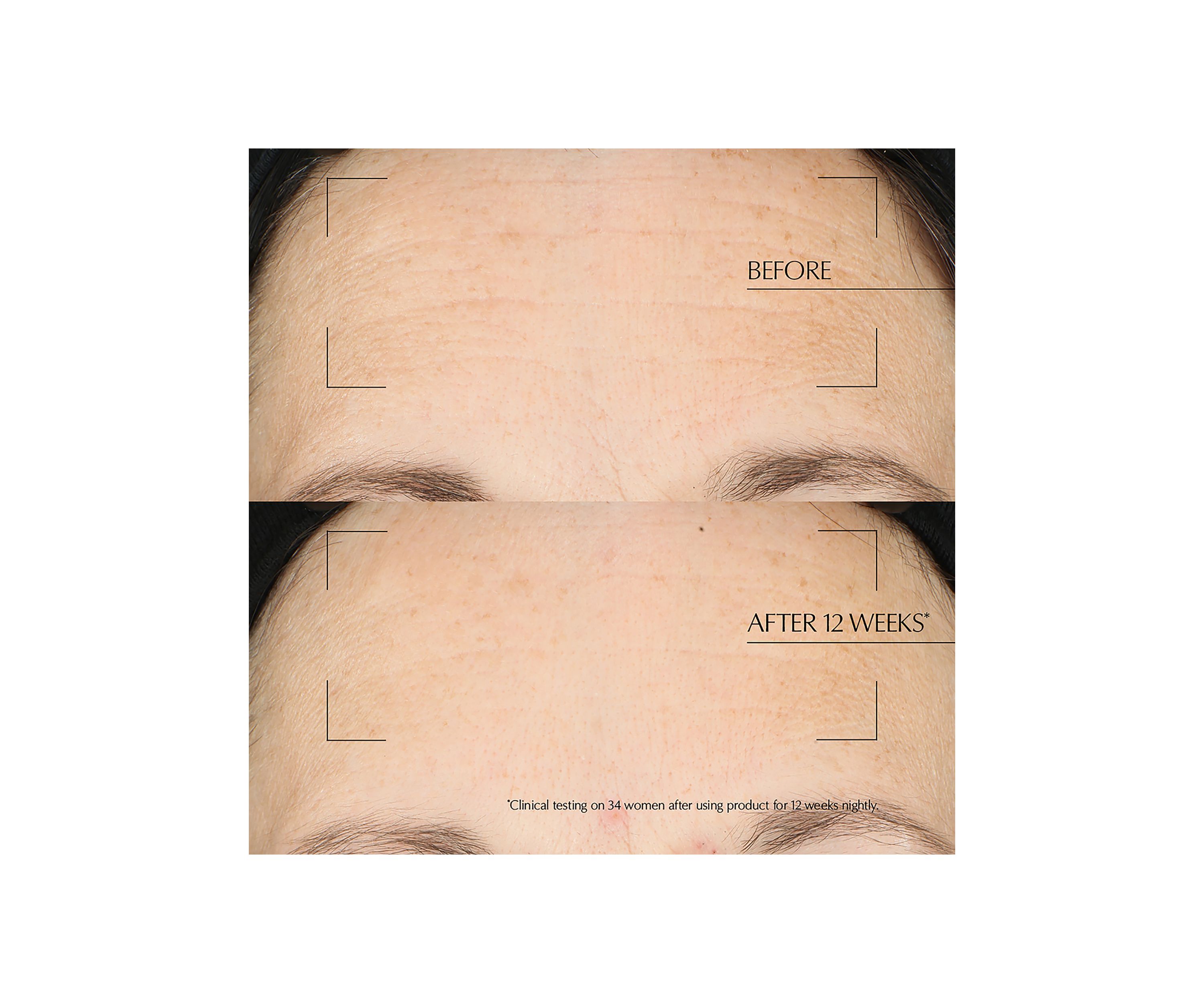 Advanced Night Repair Moisturizing Overnight Treatment with Hyaluronic Acid