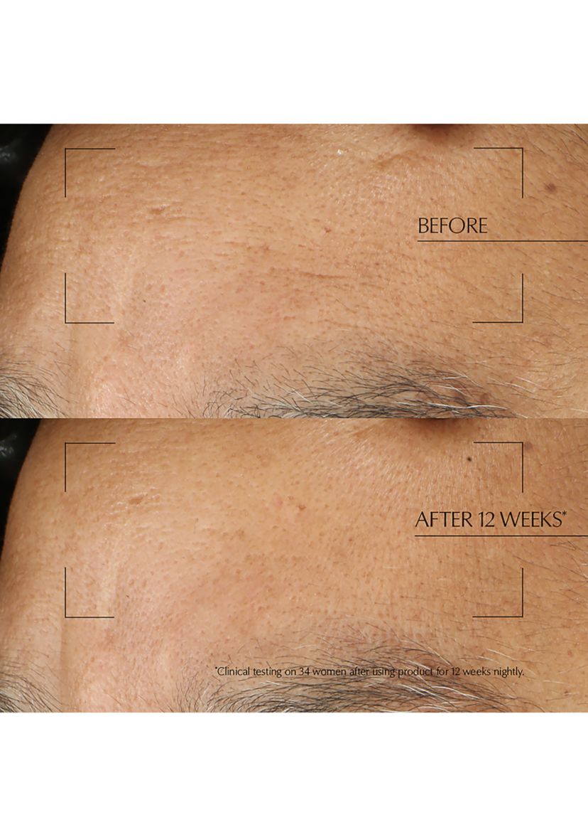 Advanced Night Repair Moisturizing Overnight Treatment with Hyaluronic Acid
