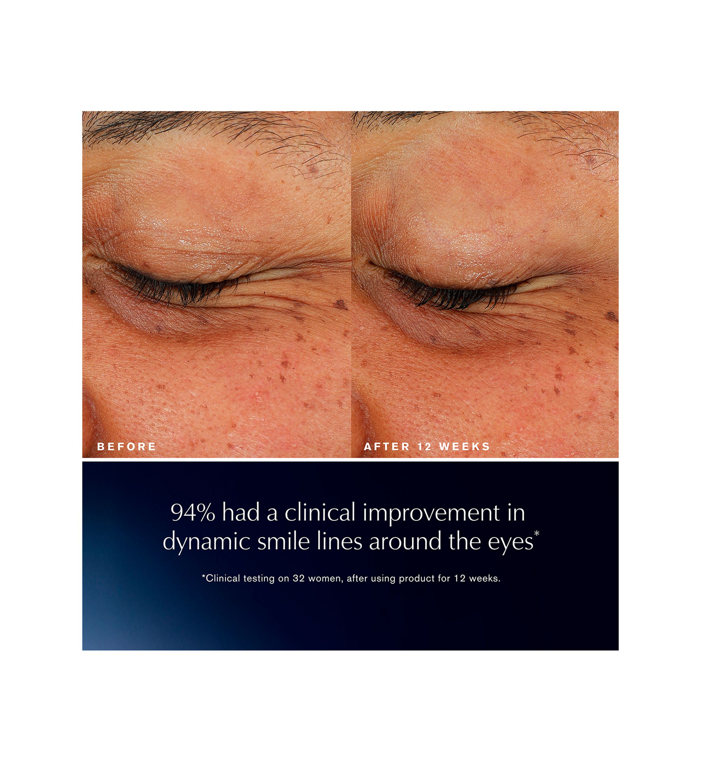 Advanced Night Repair Eye Lift + Sculpt Eye Cream