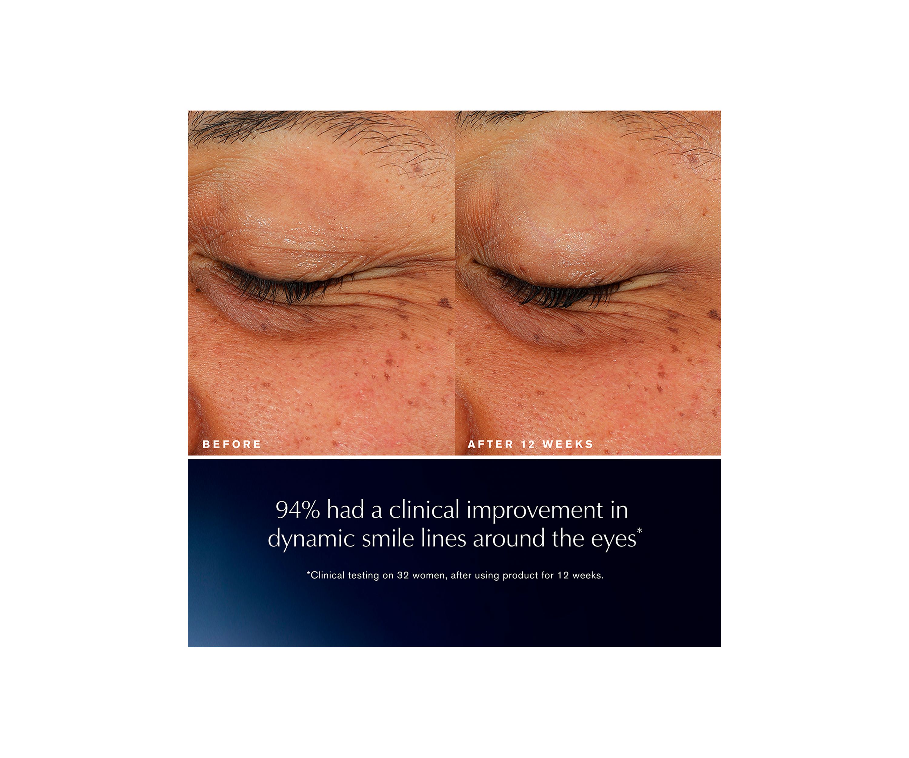 Advanced Night Repair Eye Lift + Sculpt Eye Cream