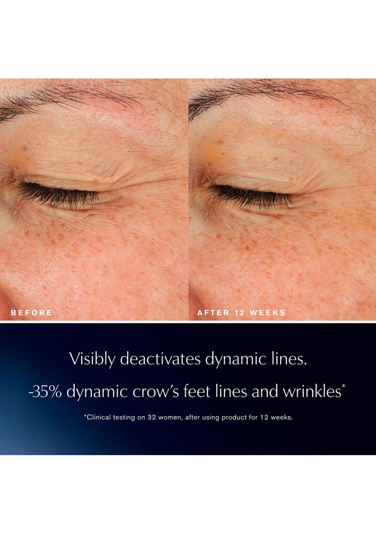 Advanced Night Repair Eye Lift + Sculpt Eye Cream