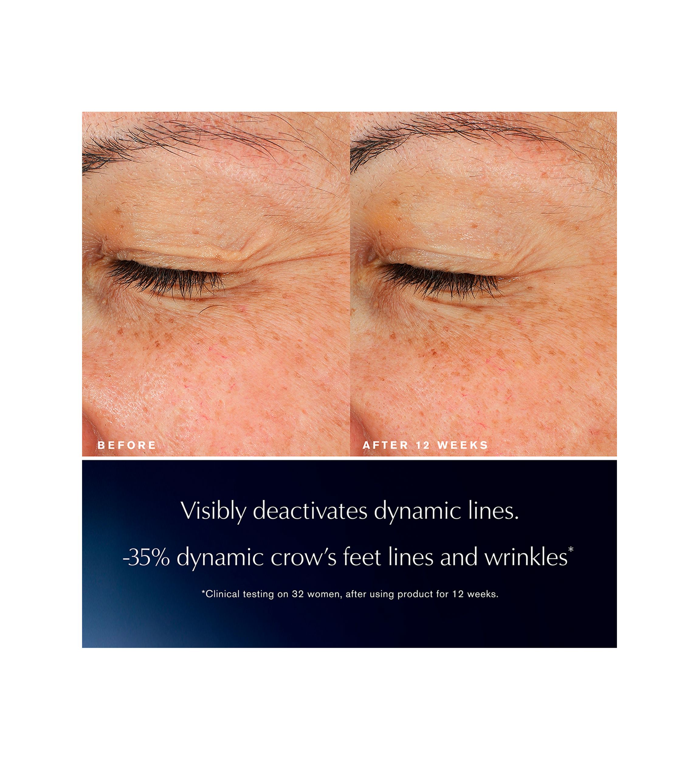 Advanced Night Repair Eye Lift + Sculpt Eye Cream