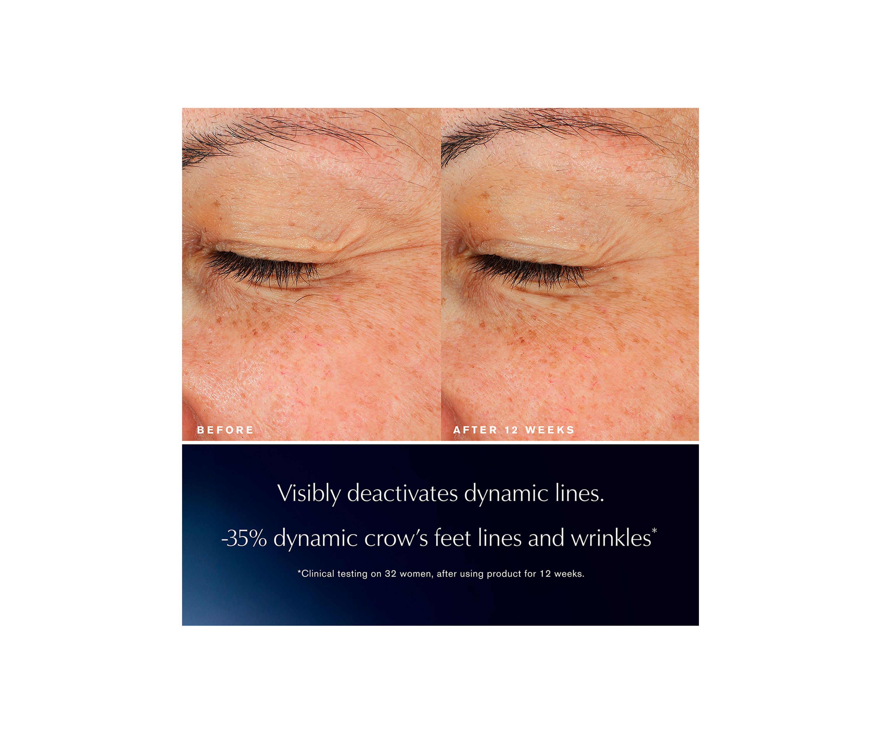 Advanced Night Repair Eye Lift + Sculpt Eye Cream