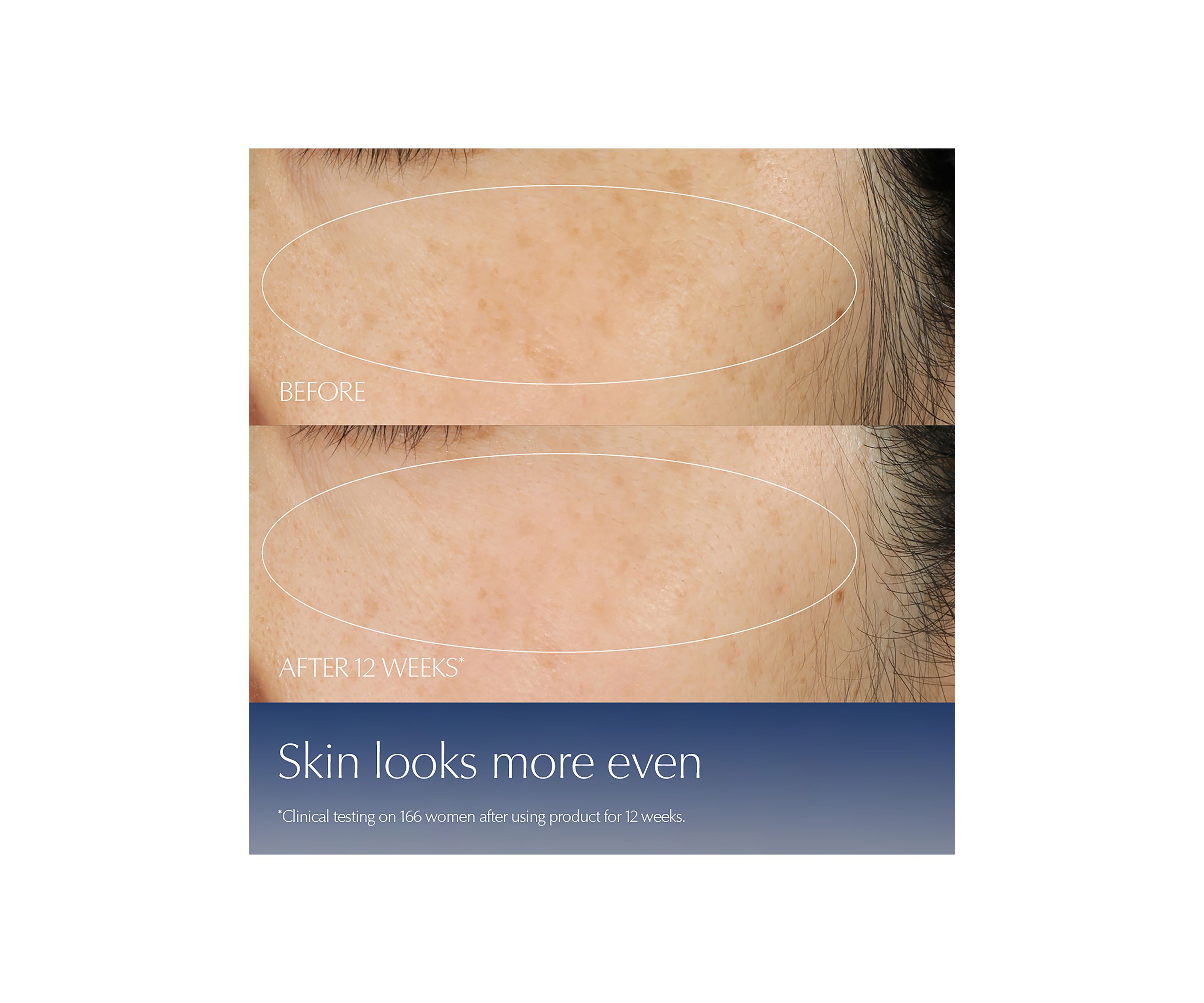 Limited Edition Advanced Night Repair Serum 