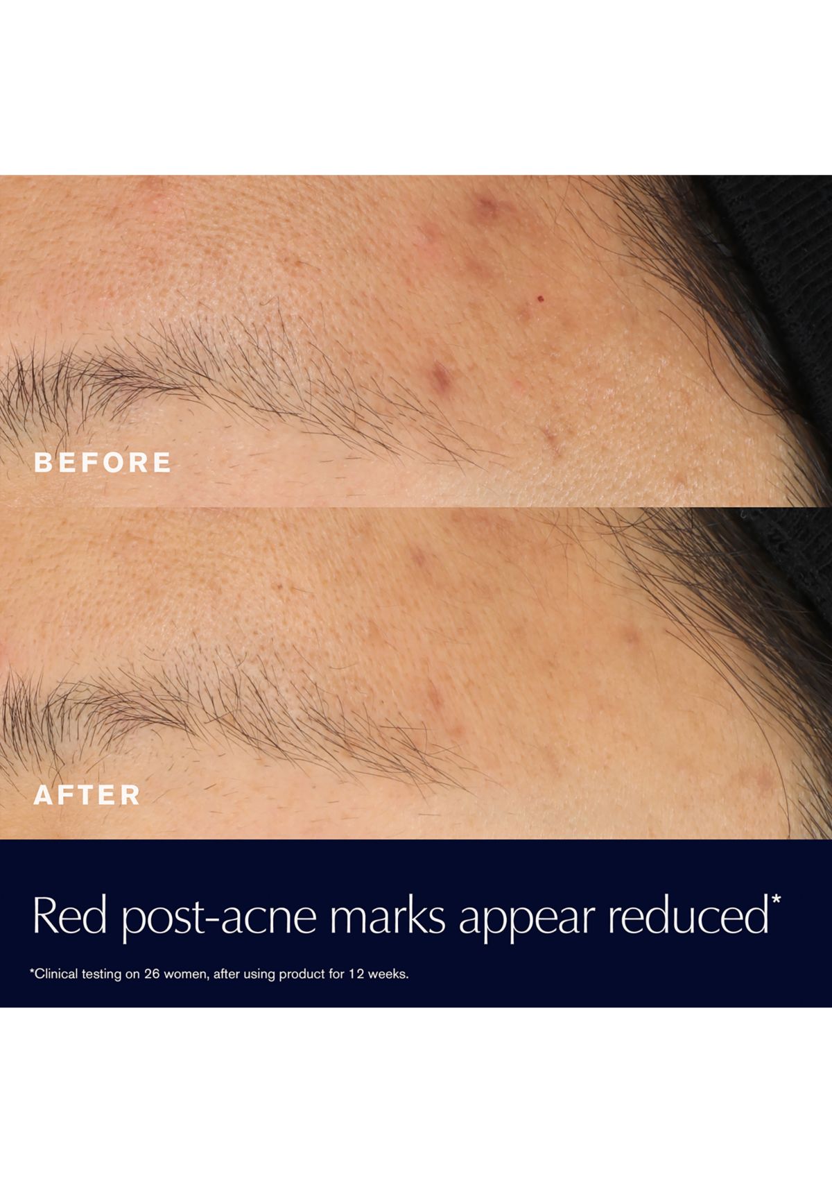 Advanced Night Repair Rescue Solution Serum with 15% Bifidus Ferment