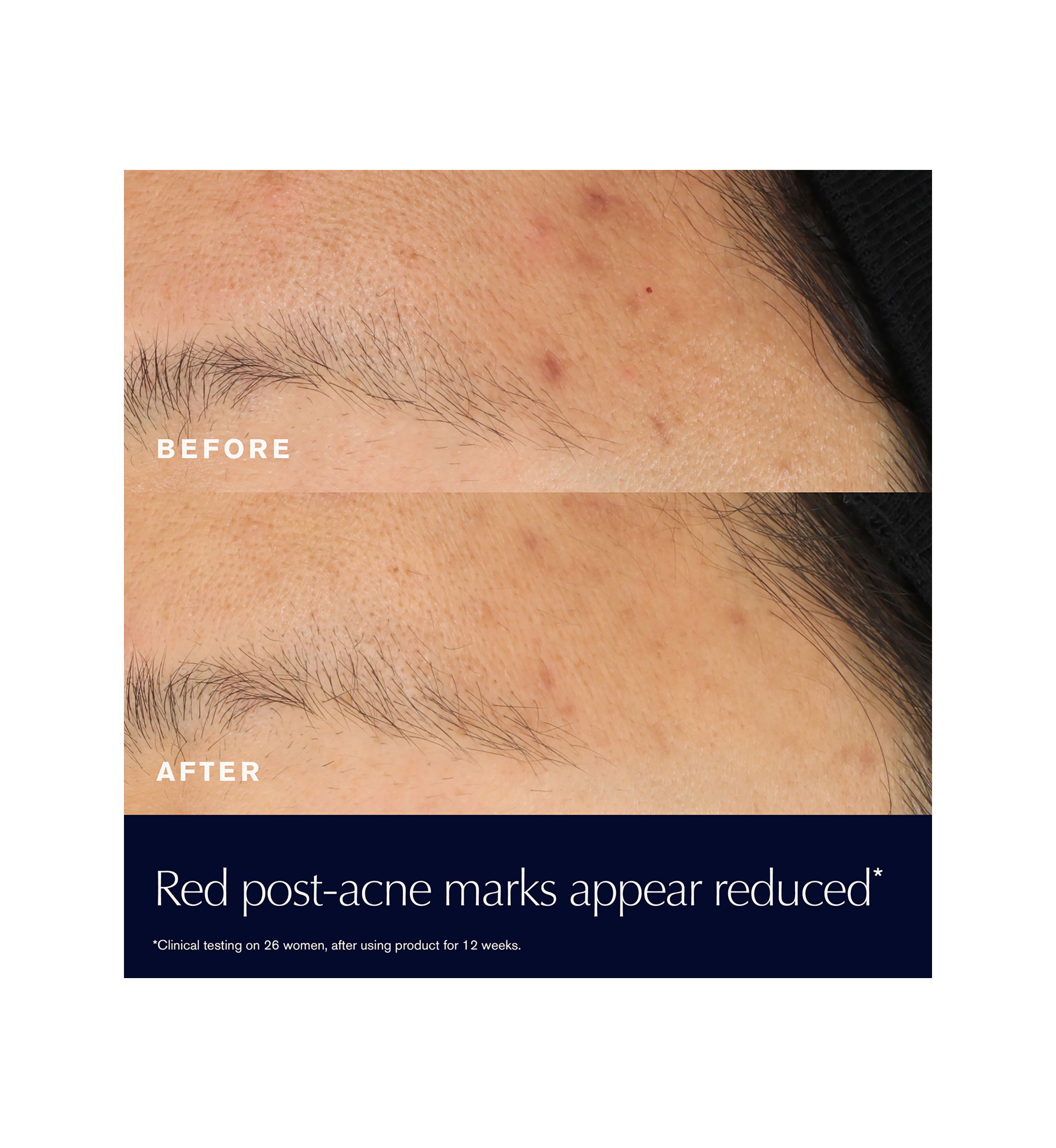 Advanced Night Repair Rescue Solution Serum with 15% Bifidus Ferment