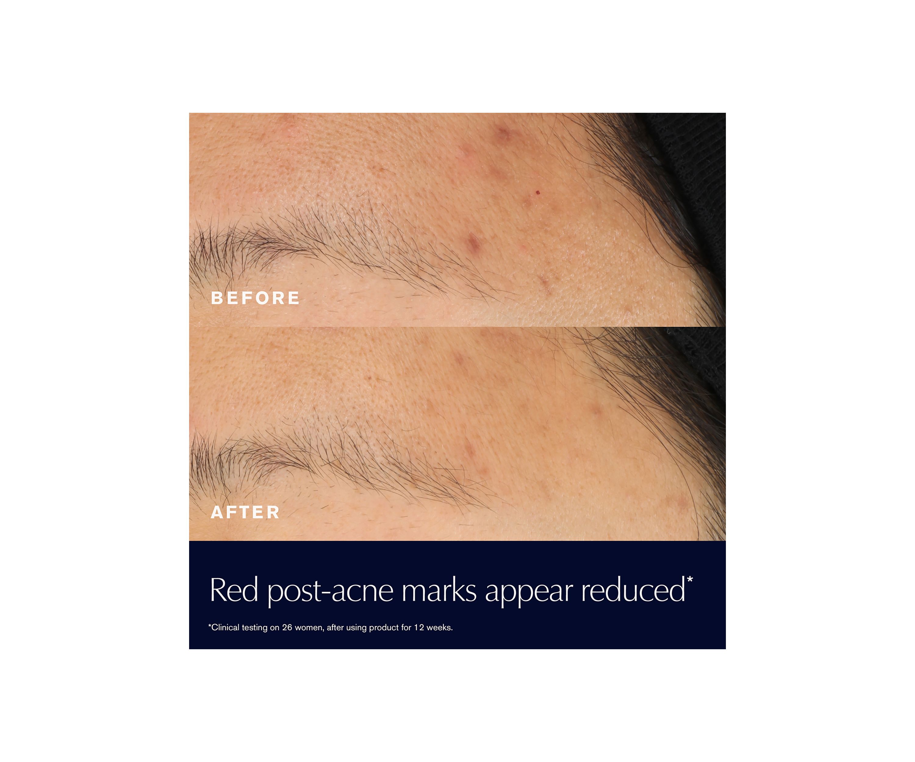 Advanced Night Repair Rescue Solution Serum with 15% Bifidus Ferment