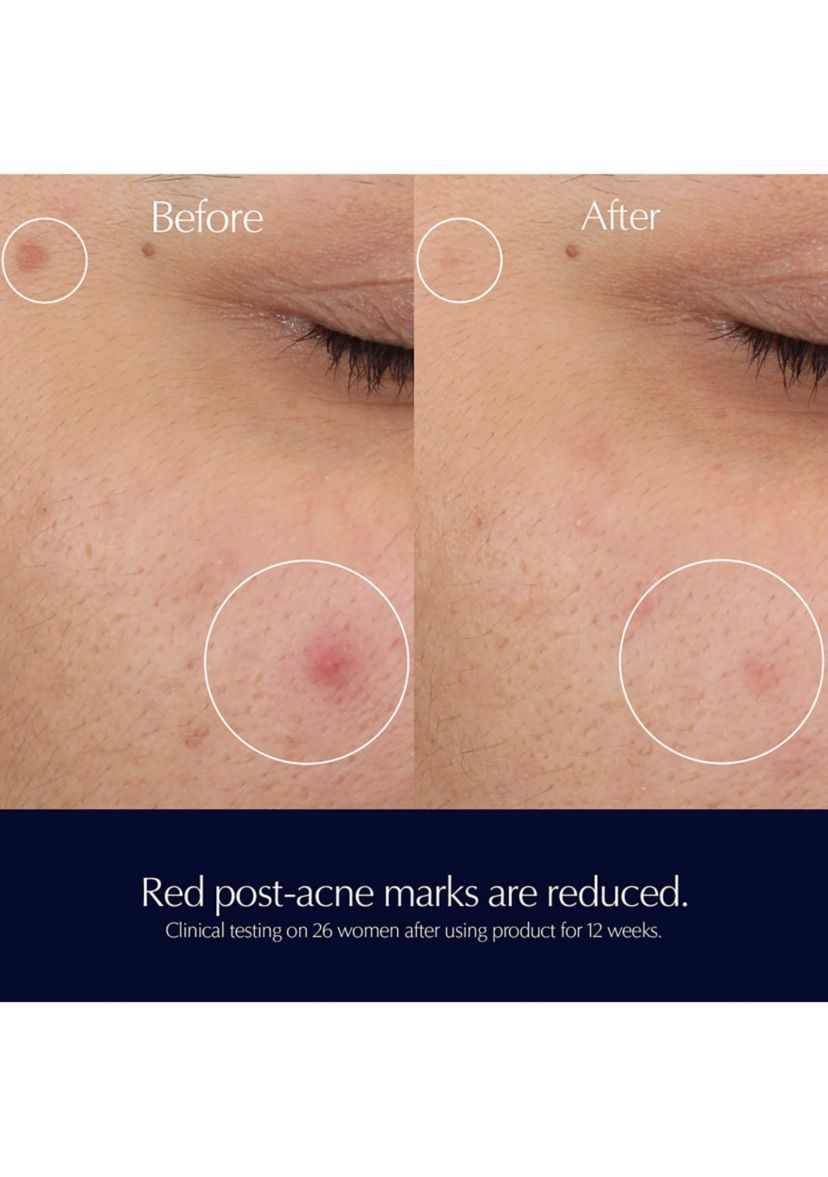 Advanced Night Repair Rescue Solution Serum with 15% Bifidus Ferment