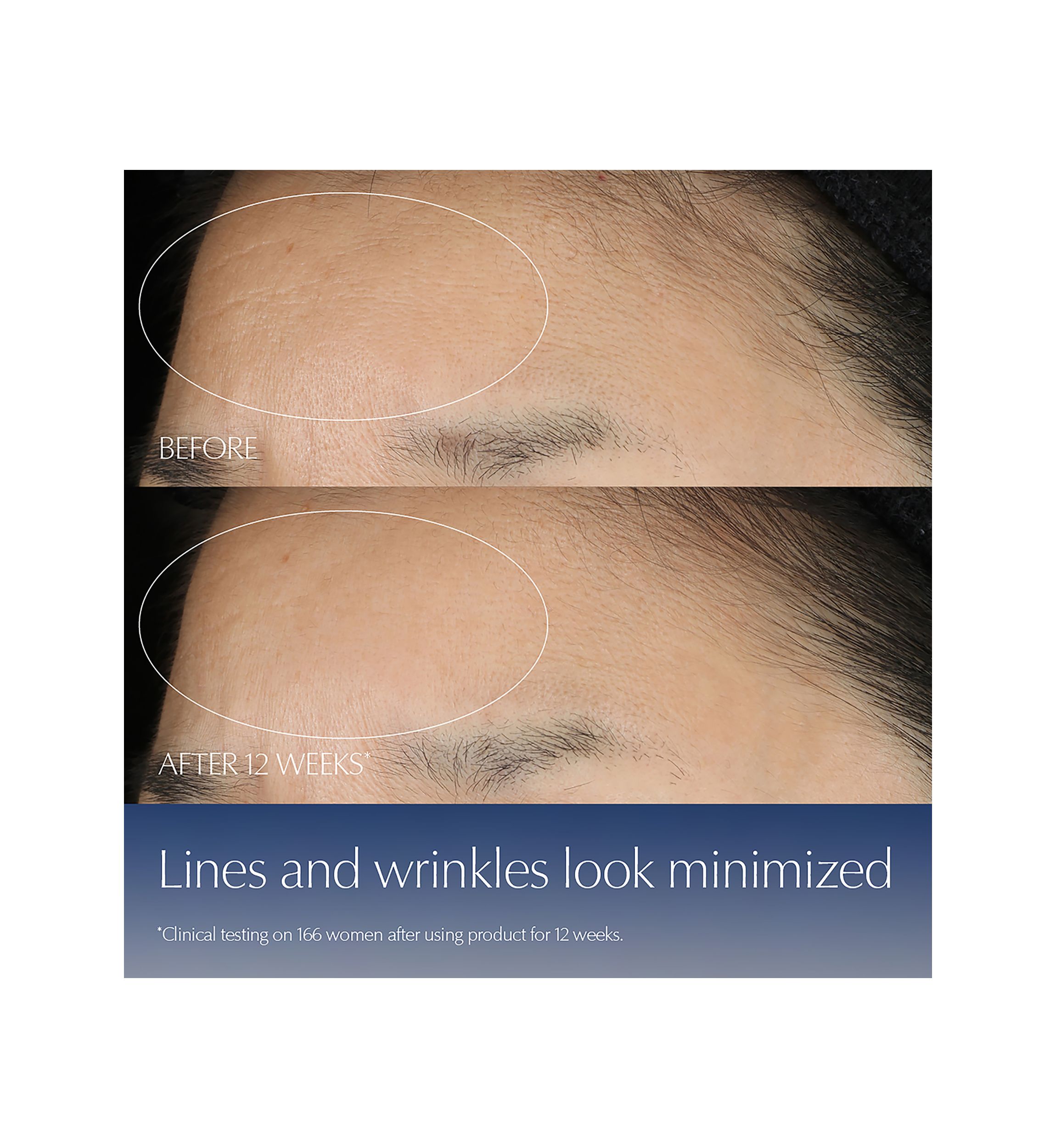 Advanced Night Repair Synchronized Multi-Recovery Complex Serum Duo with Hyaluronic Acid & Peptides