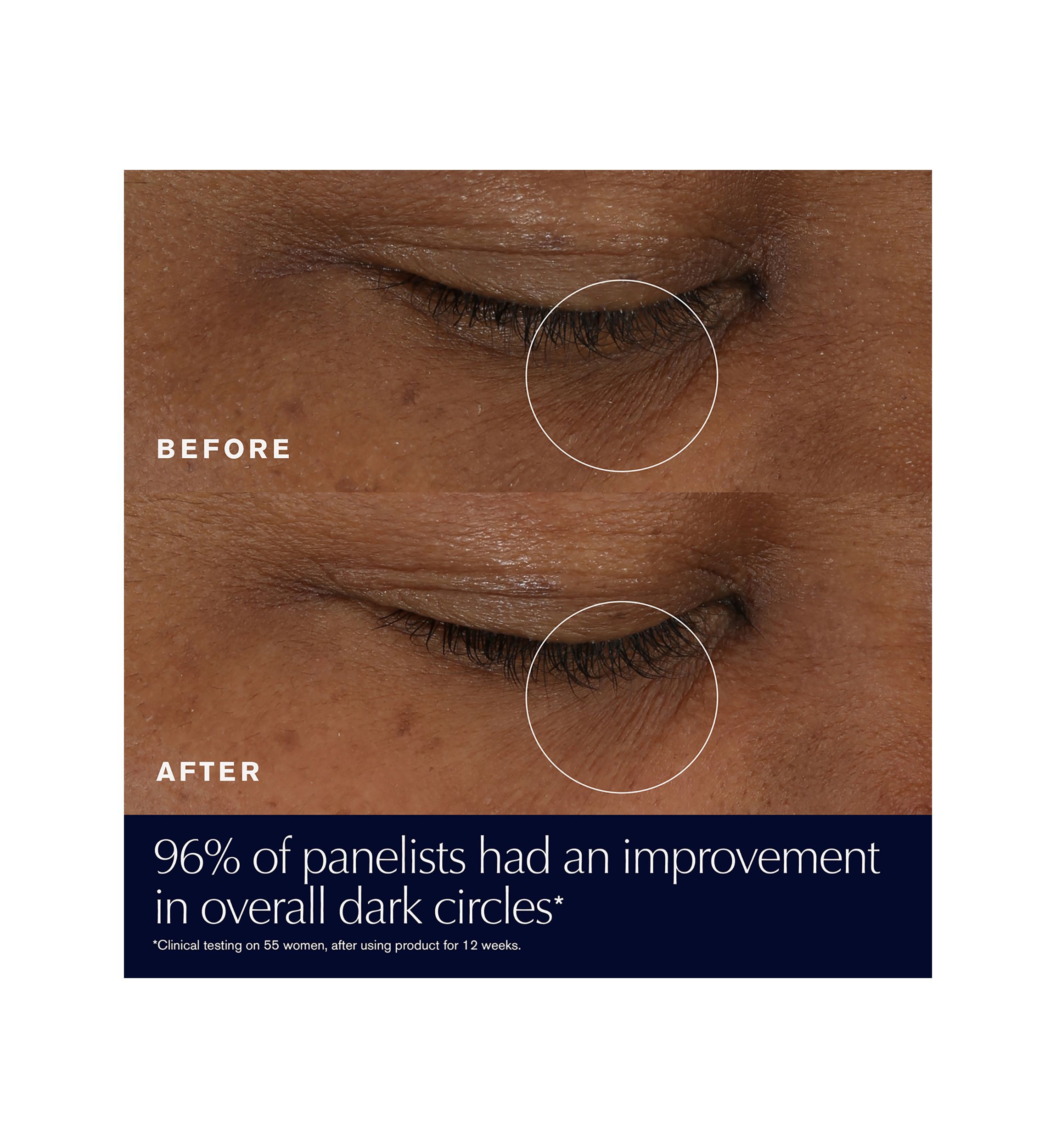 Advanced Night Repair Eye Gel-Cream