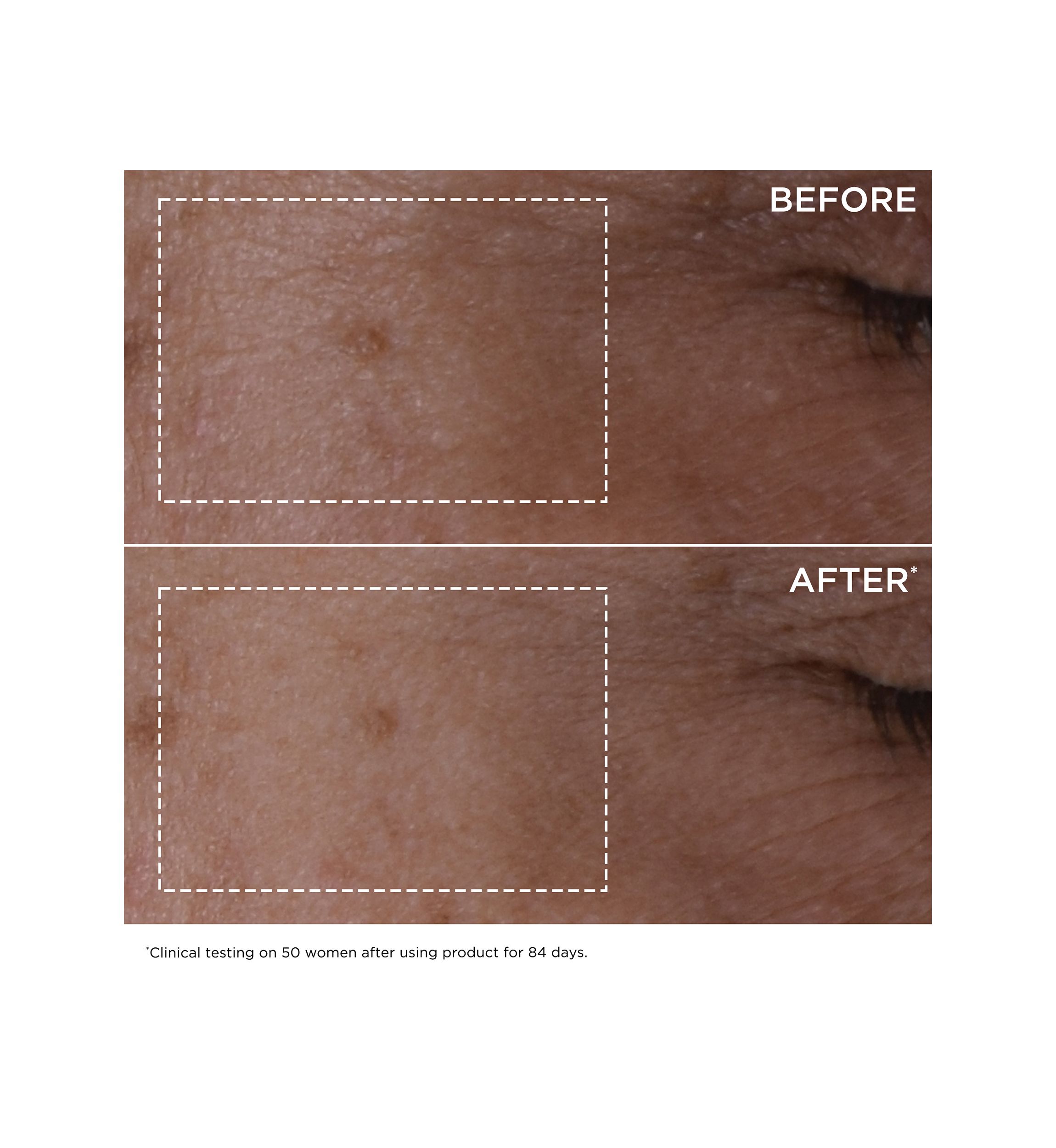 DOUBLE SERUM® To Firm, Smooth, Boost Radiance & Refine Pores