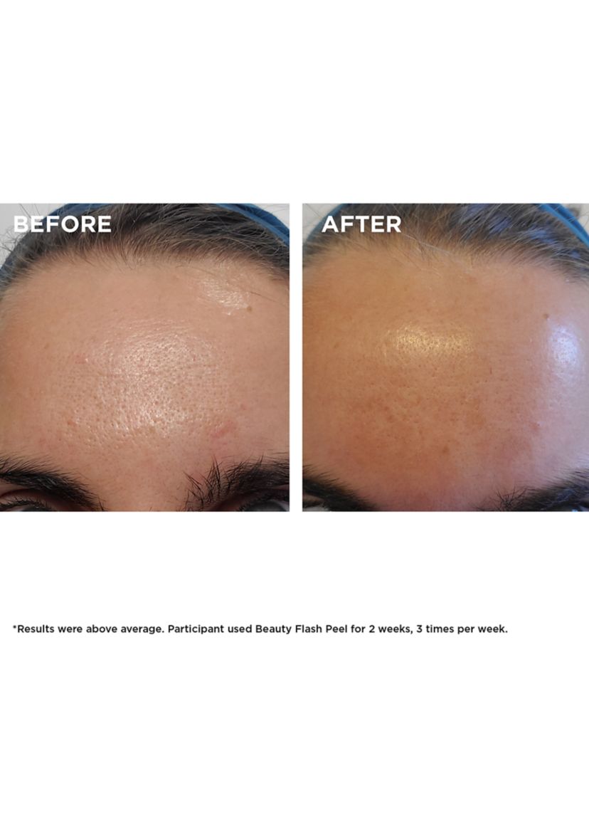 Beauty Flash Peel with BHA & AHA