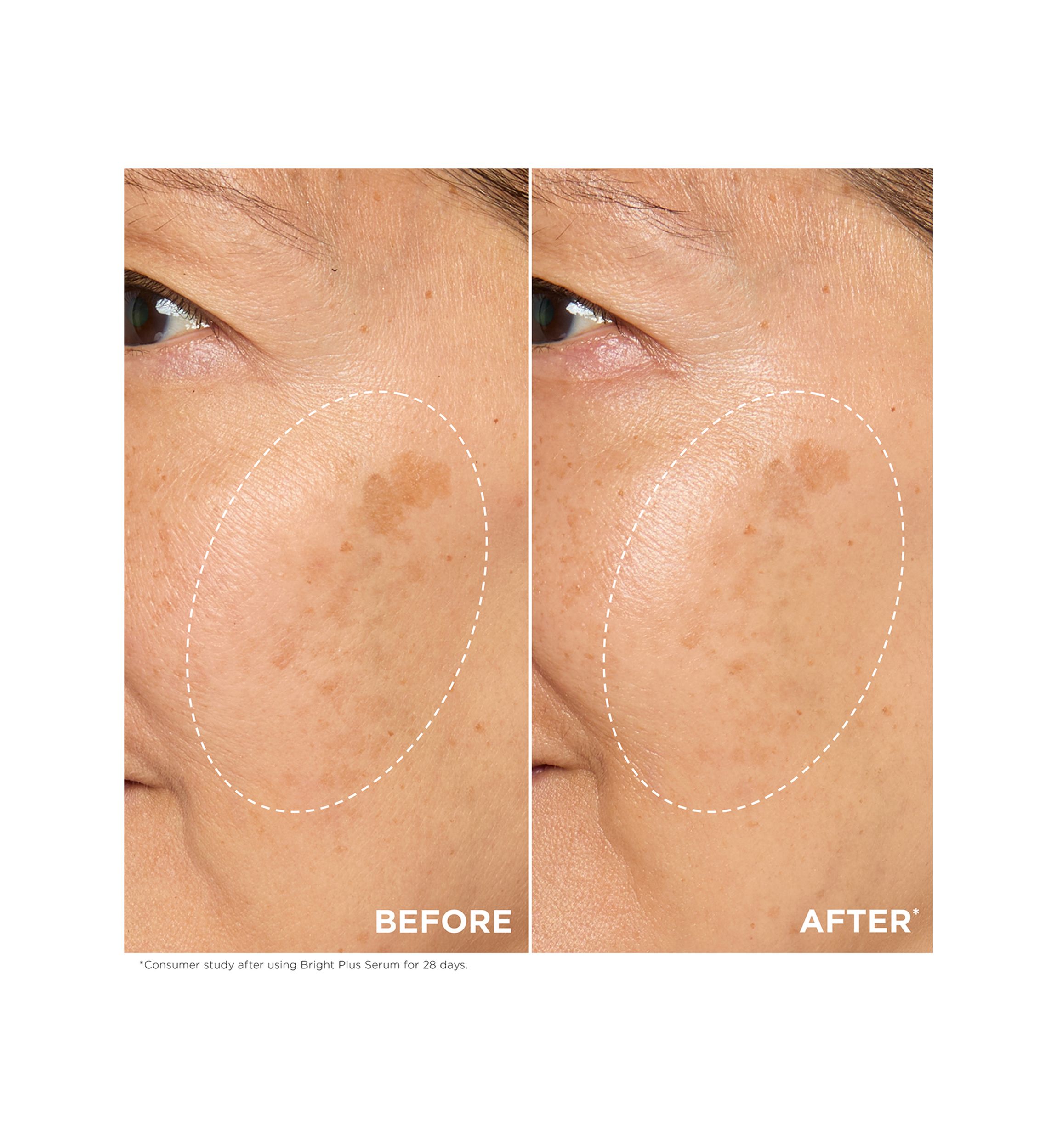 Bright Plus Brightening Vitamin C & Niacinamide Dark Spot Serum