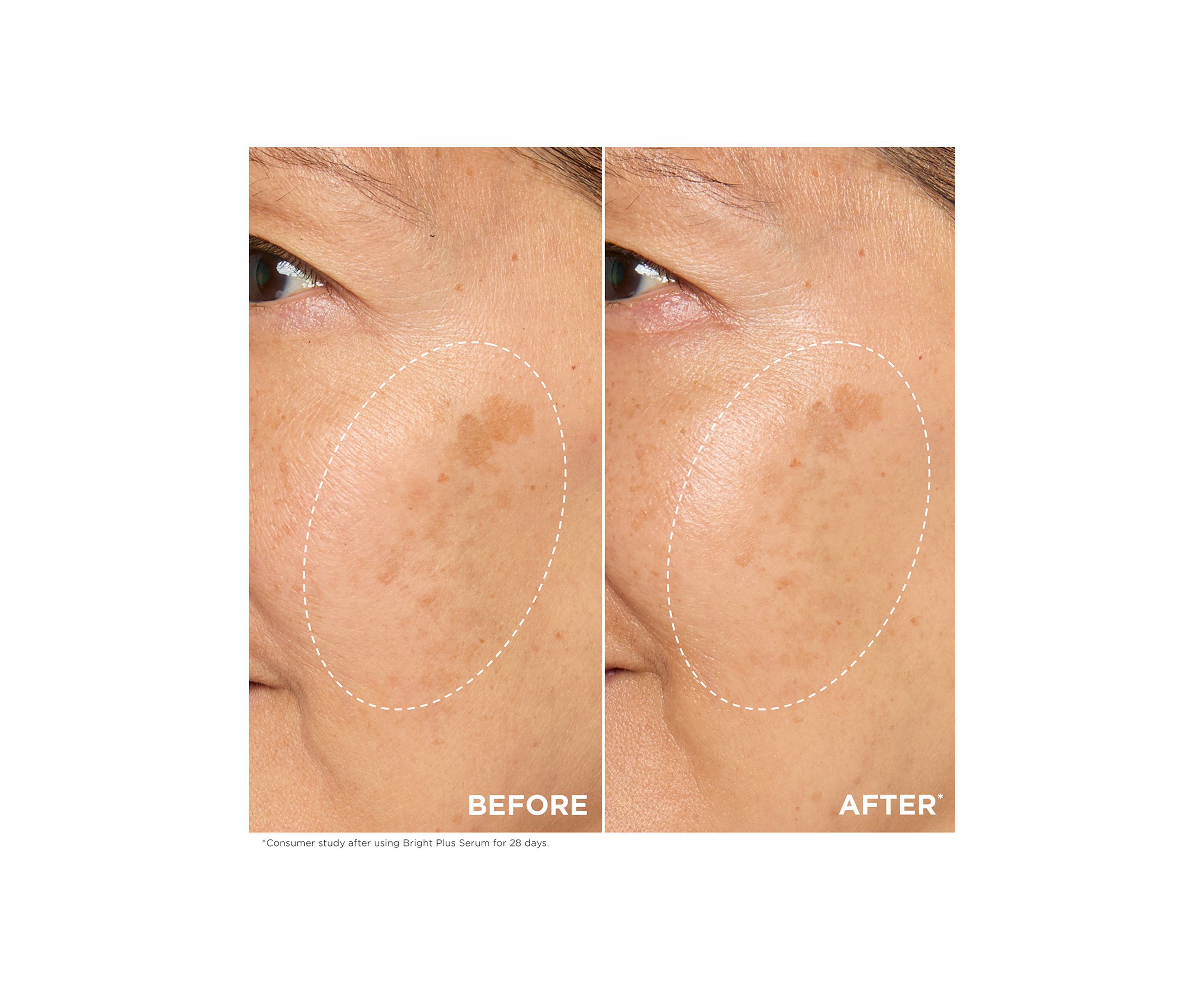 Bright Plus Brightening Vitamin C & Niacinamide Dark Spot Serum