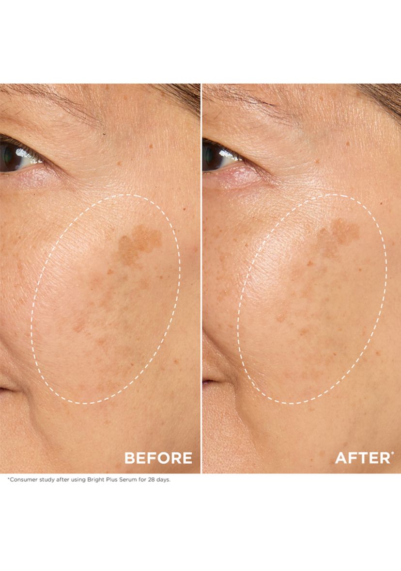 Bright Plus Brightening Vitamin C & Niacinamide Dark Spot Serum