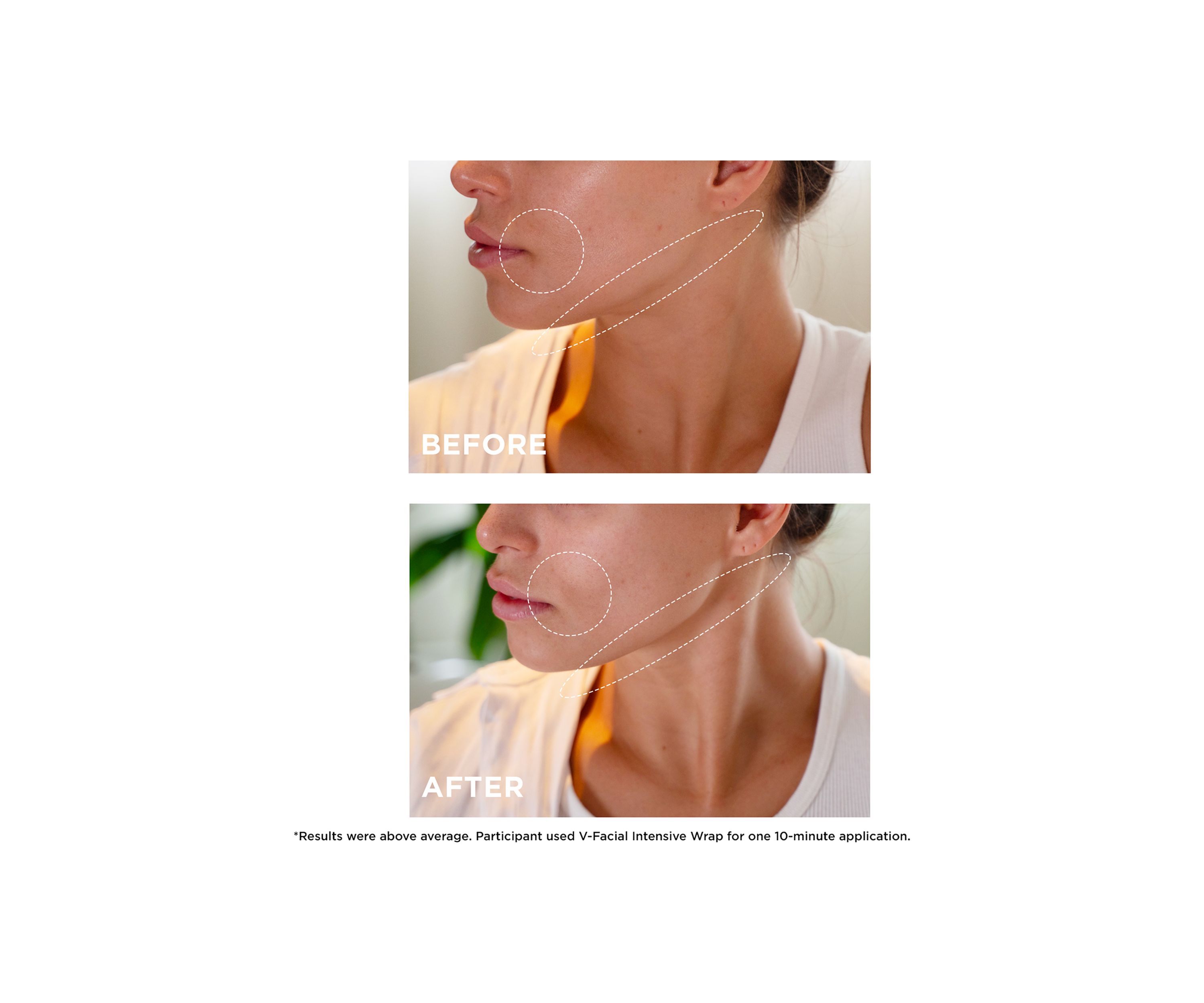 V-Facial Instant Depuffing Face Mask