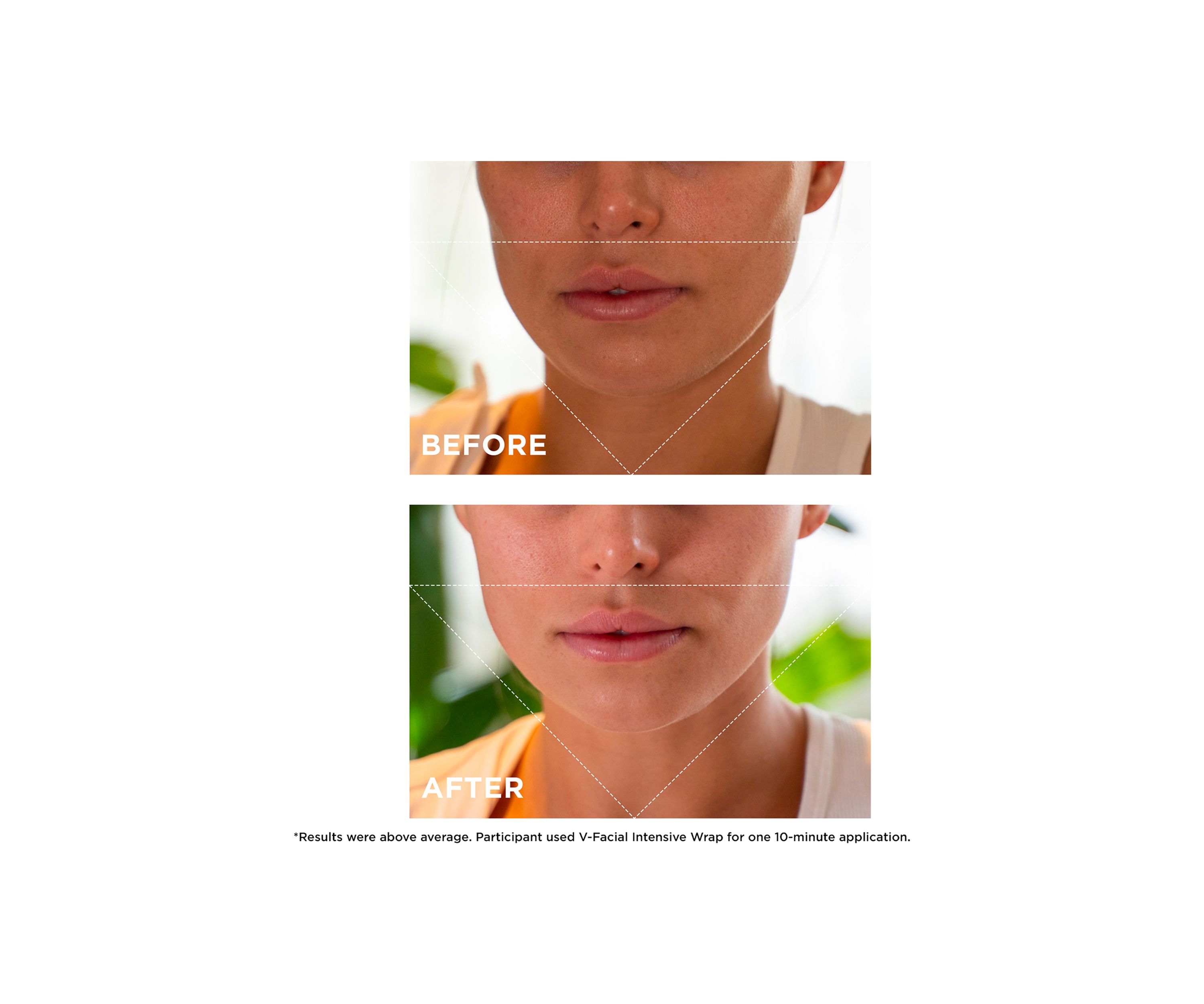 V-Facial Instant Depuffing Face Mask