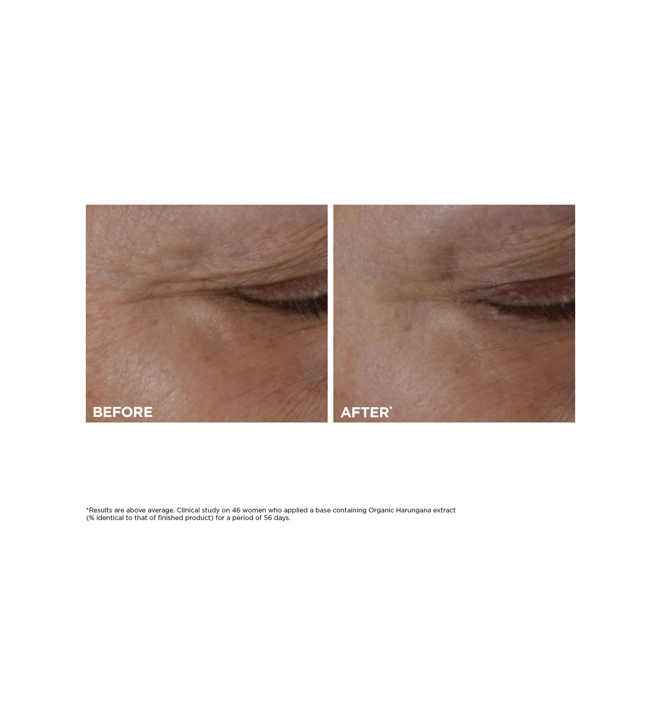 Total Eye Lift Refillable Eye Cream for Firming, Wrinkles, Dark Circles & Puffiness