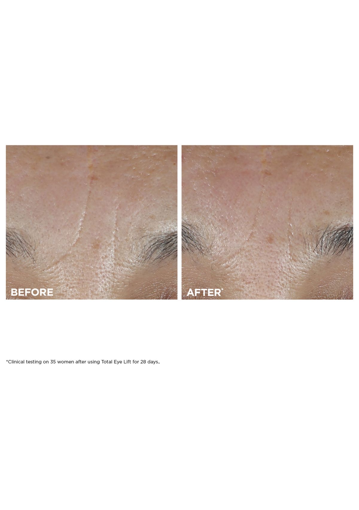 Total Eye Lift Refillable Eye Cream for Firming, Wrinkles, Dark Circles & Puffiness