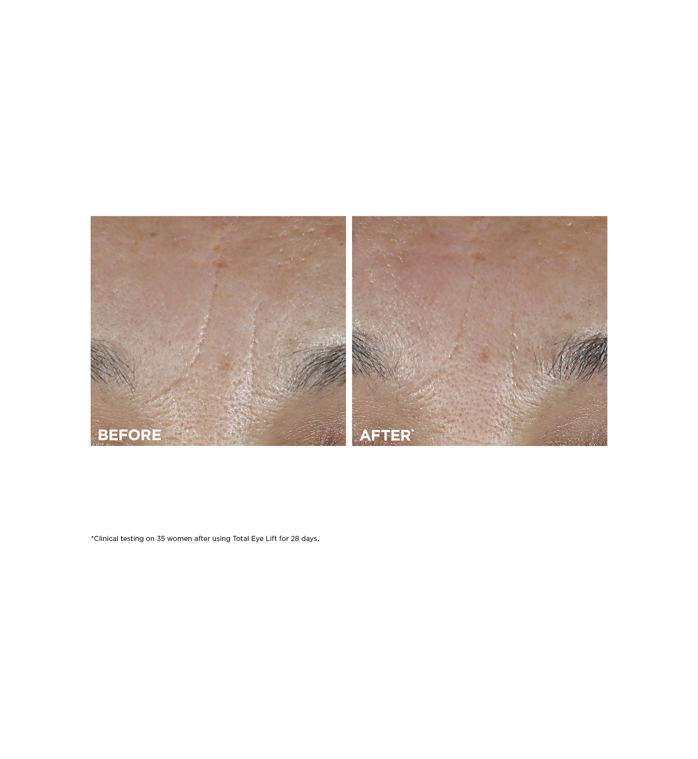 Total Eye Lift Refillable Eye Cream for Firming, Wrinkles, Dark Circles & Puffiness