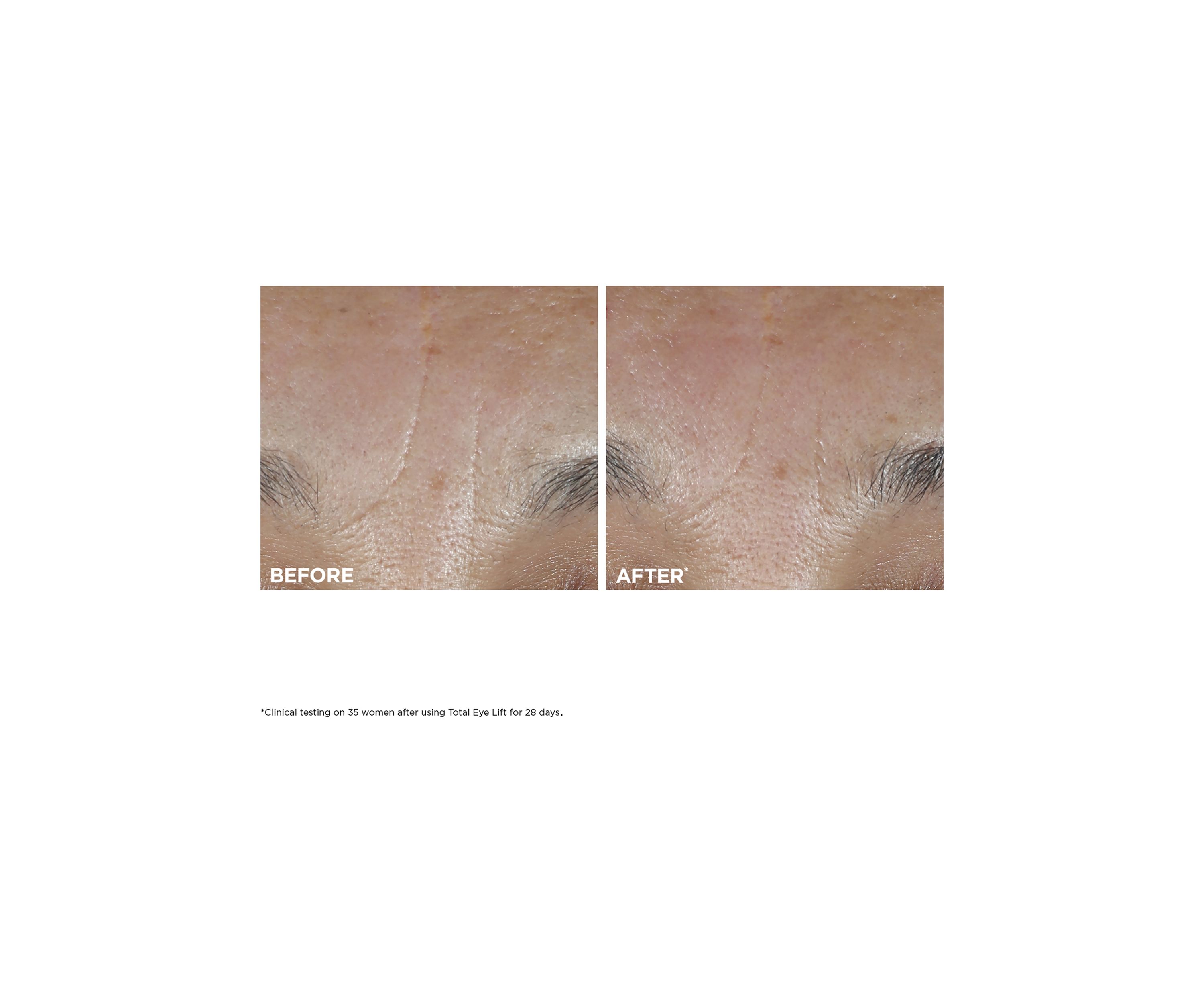 Total Eye Lift Refillable Eye Cream for Firming, Wrinkles, Dark Circles & Puffiness