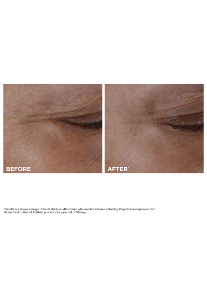 Total Eye Lift Eye Cream Refill for Firming, Wrinkles, Dark Circles & Puffiness
