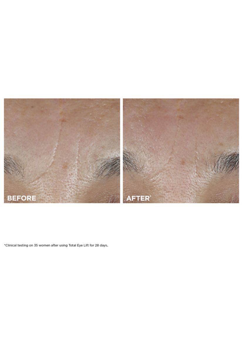 Total Eye Lift Eye Cream Refill for Firming, Wrinkles, Dark Circles & Puffiness