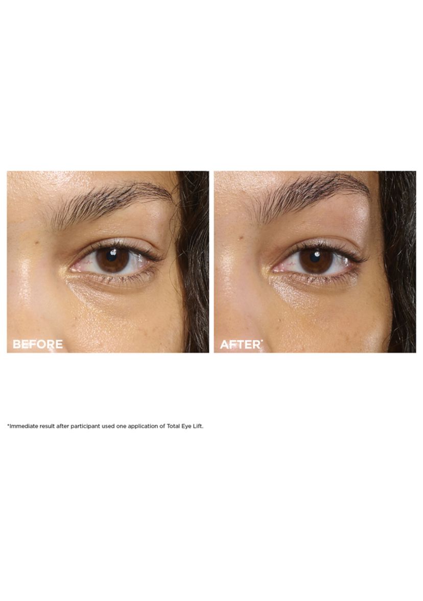 Total Eye Lift Eye Cream Refill for Firming, Wrinkles, Dark Circles & Puffiness