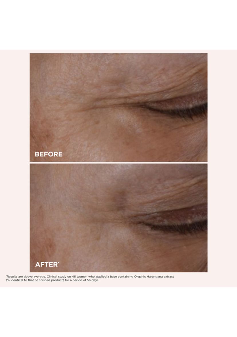 Total Eye Lift Set for Firming, Wrinkles, Dark Circles & Puffiness - $141 Value!