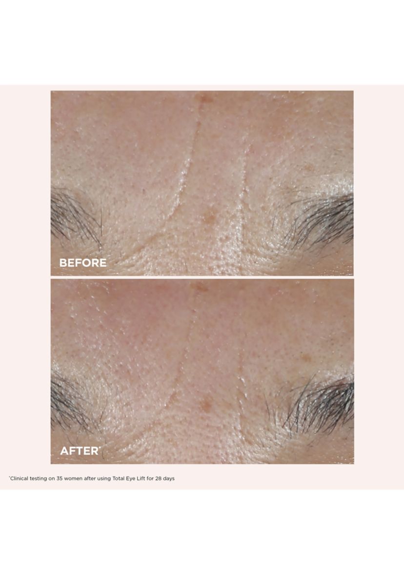 Total Eye Lift Set for Firming, Wrinkles, Dark Circles & Puffiness - $141 Value!