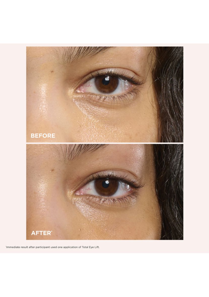 Total Eye Lift Set for Firming, Wrinkles, Dark Circles & Puffiness - $141 Value!