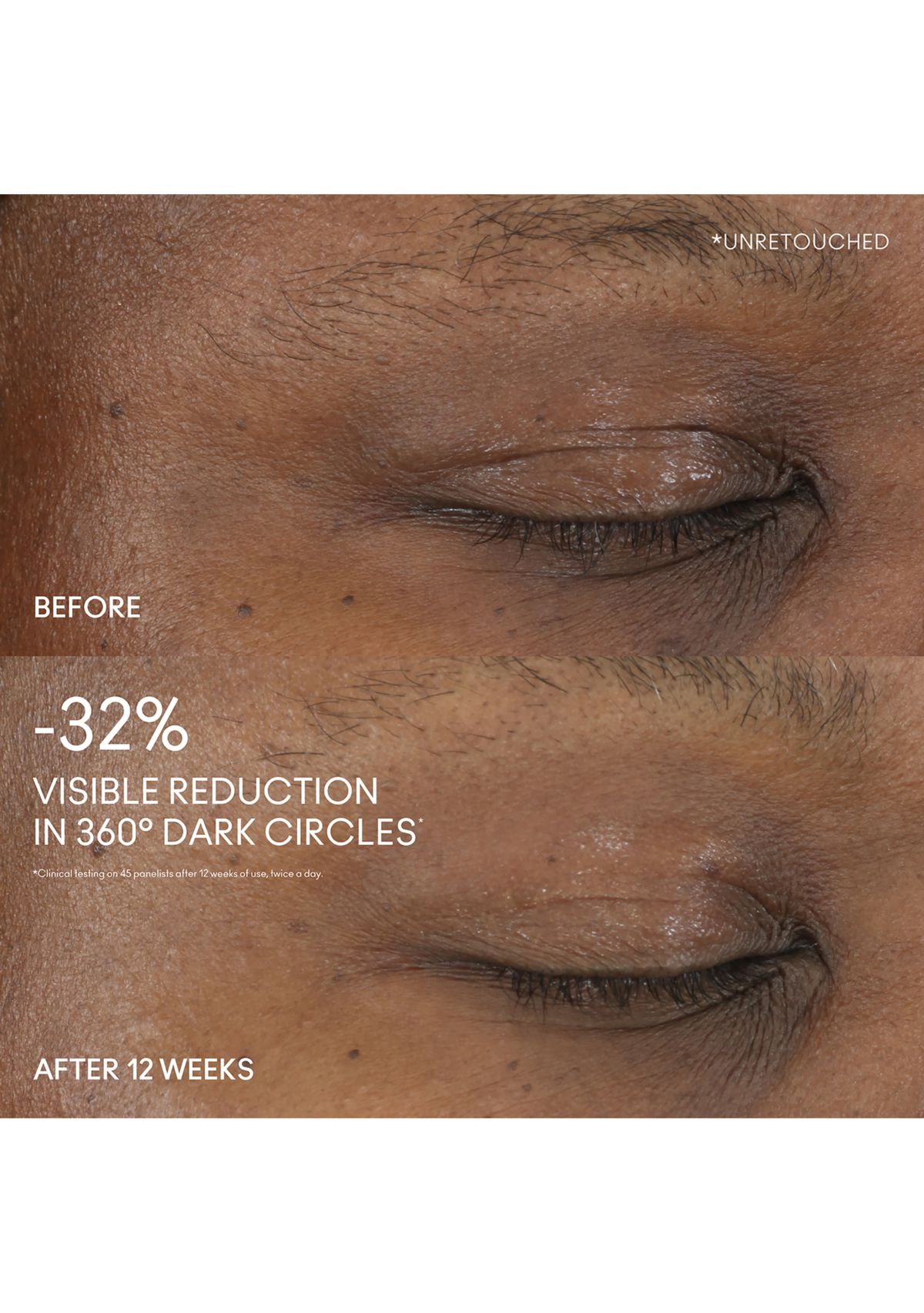 Hyper Real Serumizer Eye Treatment 