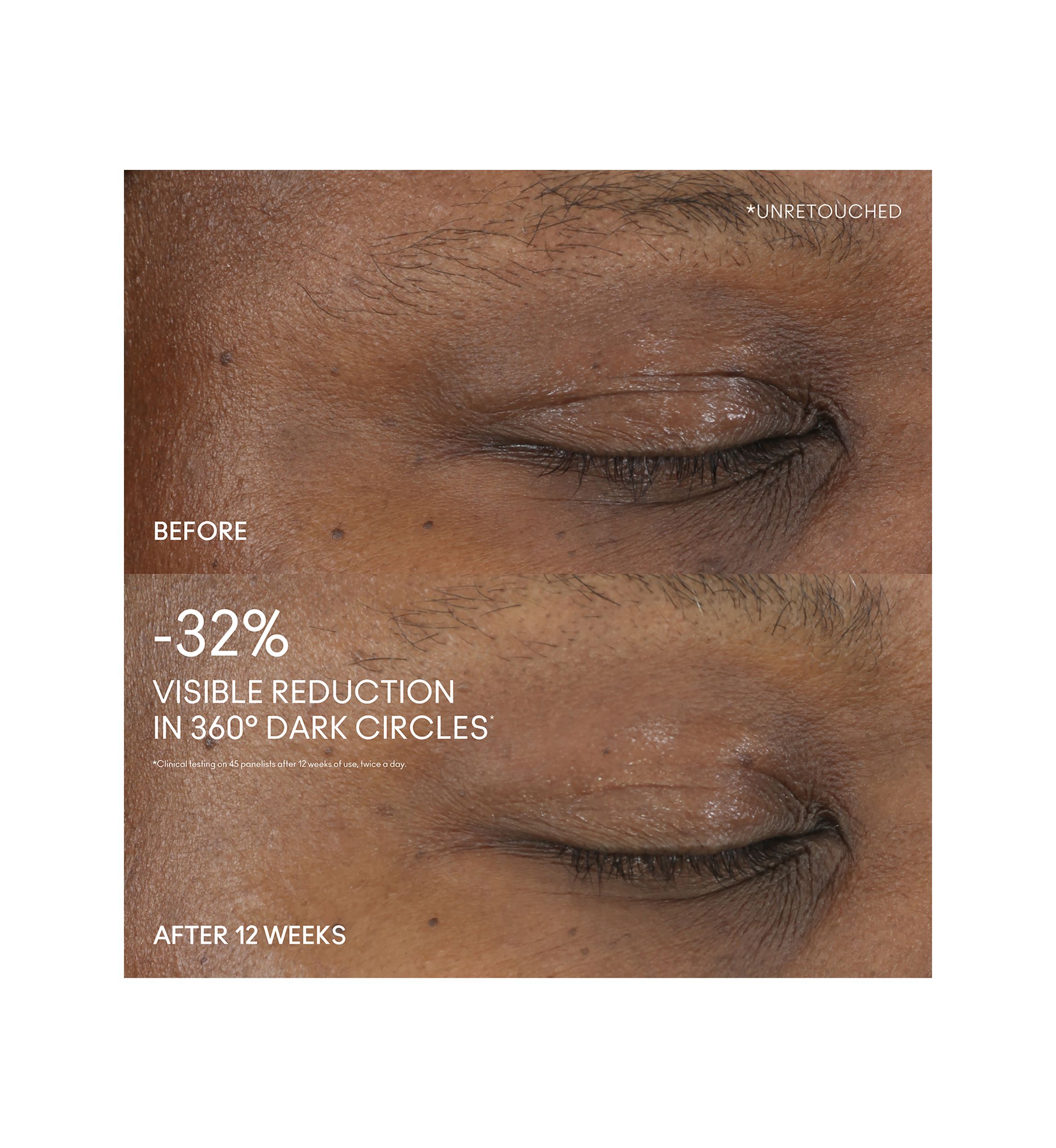 Hyper Real Serumizer Eye Treatment 