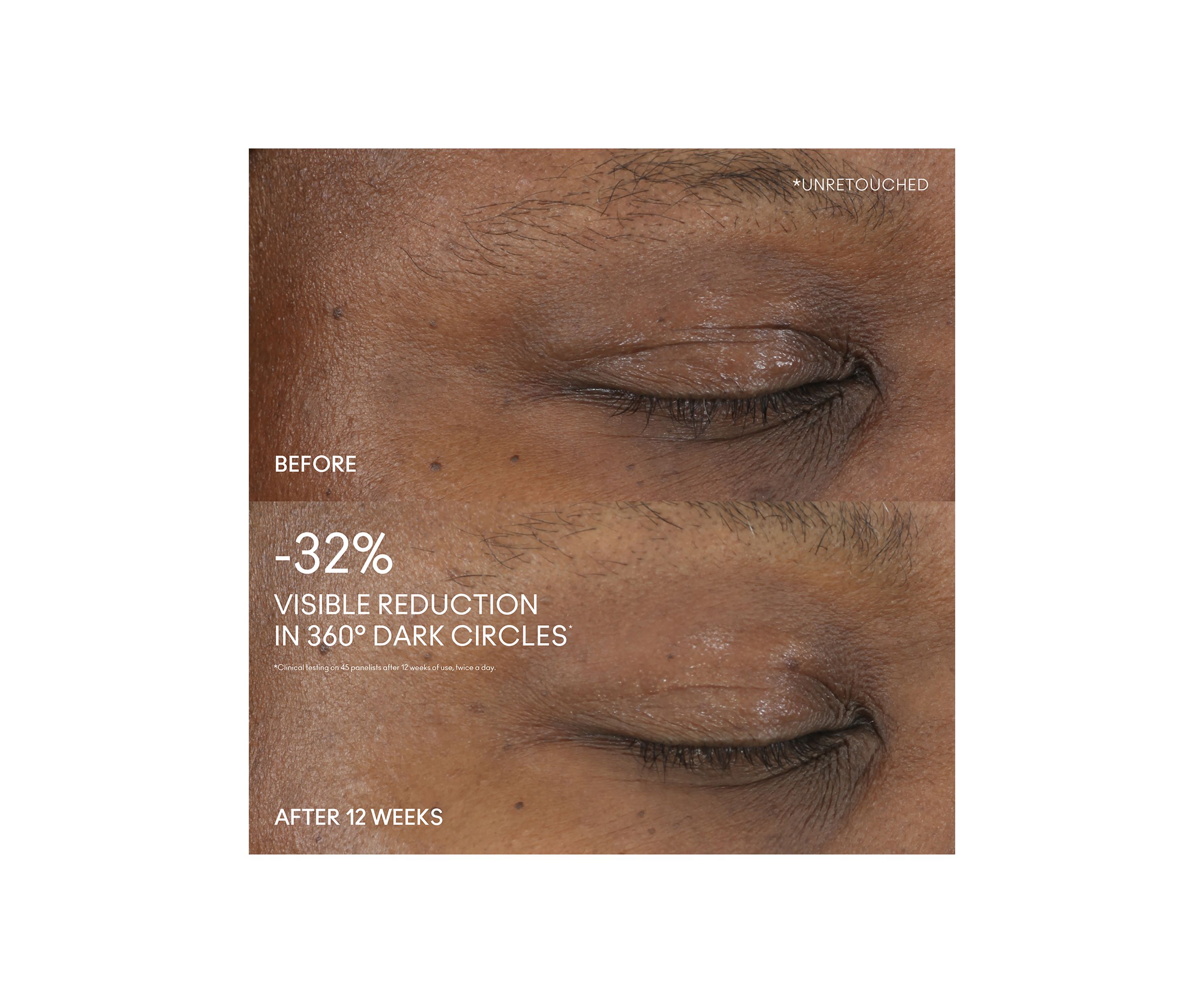 Hyper Real Serumizer Eye Treatment 