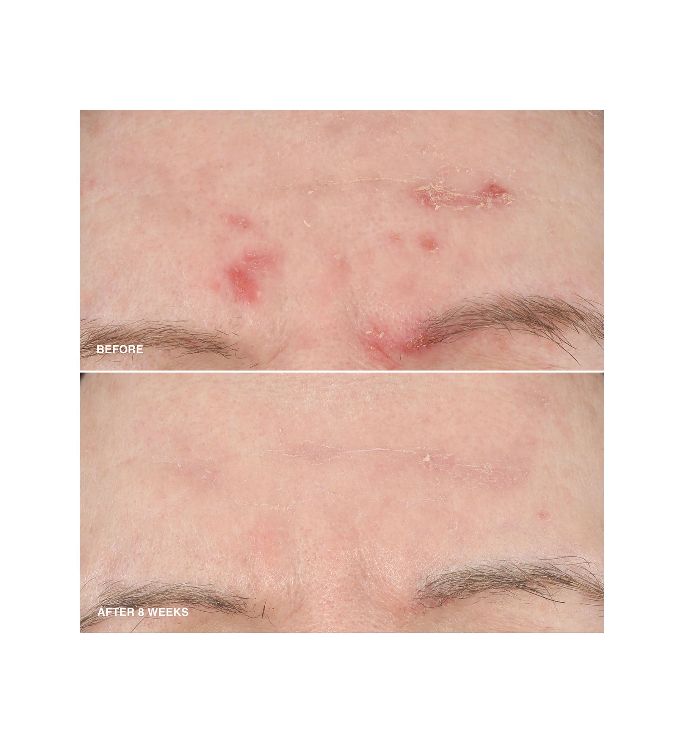 Vitamin Enriched Smoothing Serum with Niacinamide 