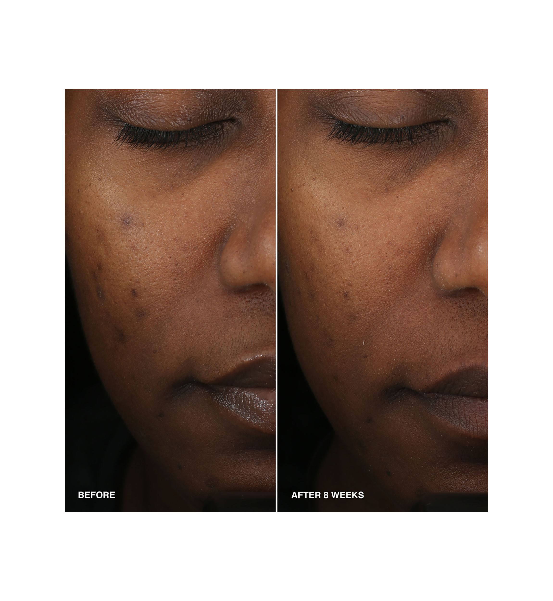 Vitamin Enriched Smoothing Serum with Niacinamide 