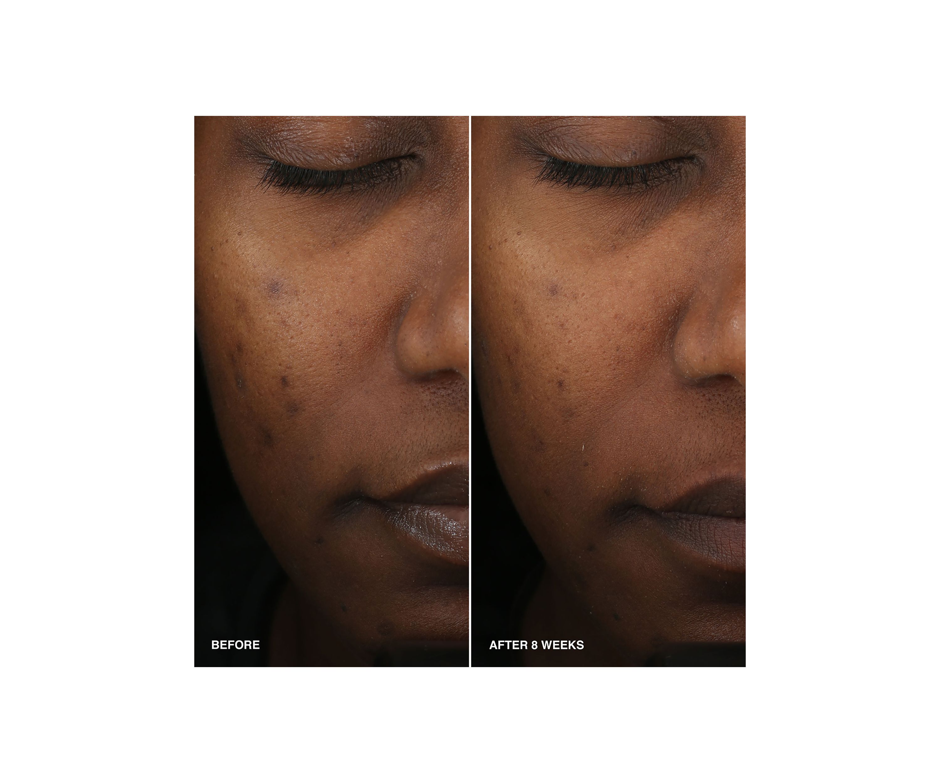 Vitamin Enriched Smoothing Serum with Niacinamide 