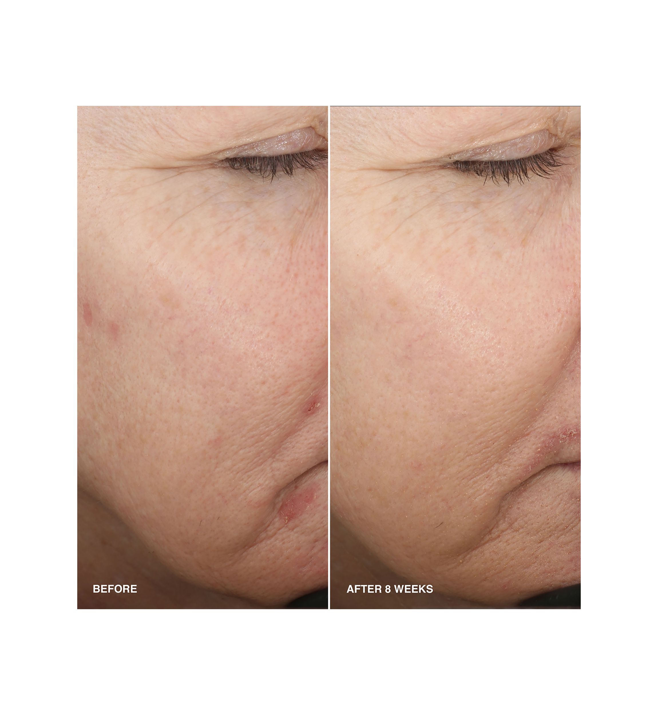 Vitamin Enriched Smoothing Serum with Niacinamide 