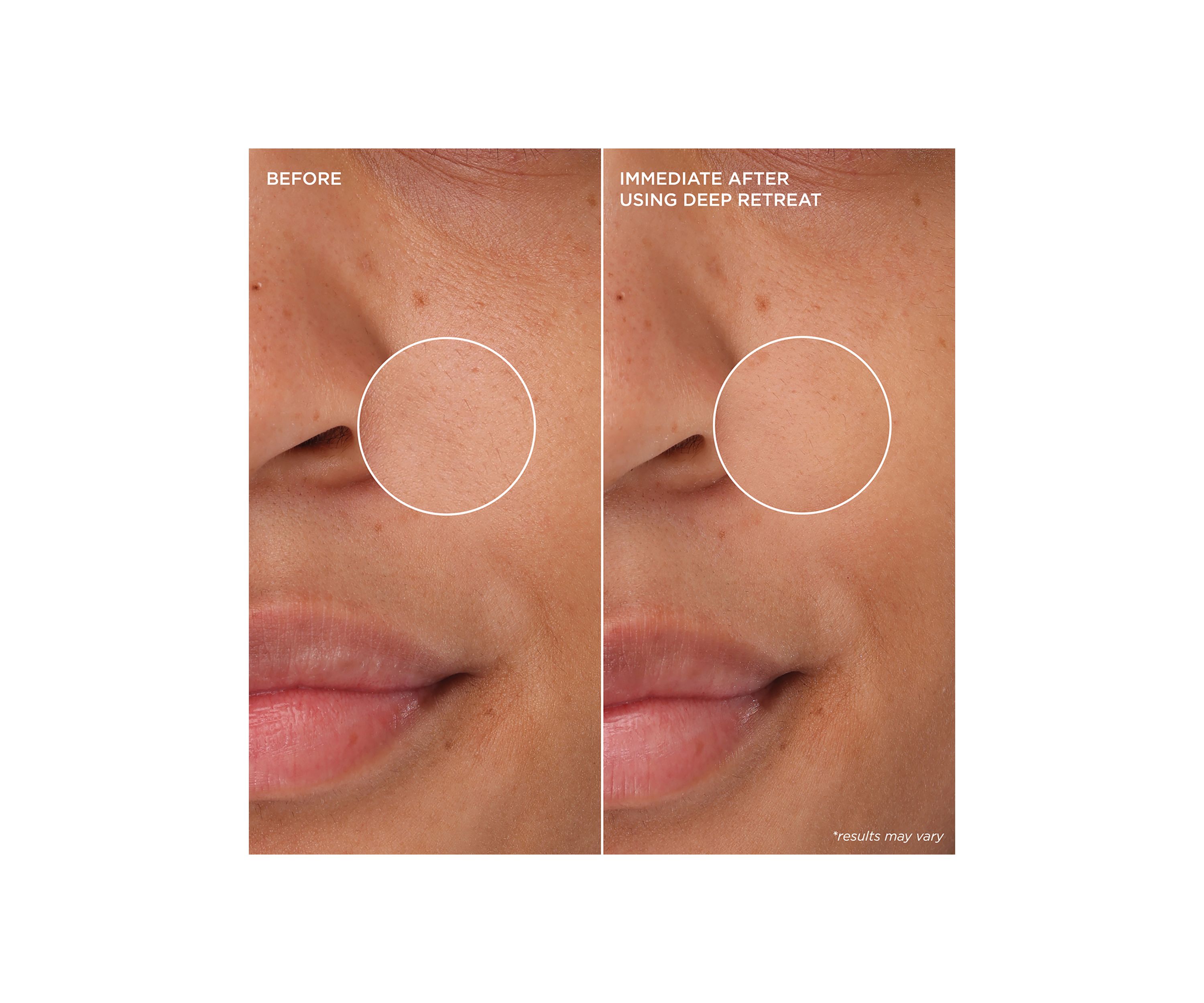 The POREfessional Deep Retreat Pore-Clearing Clay Mask