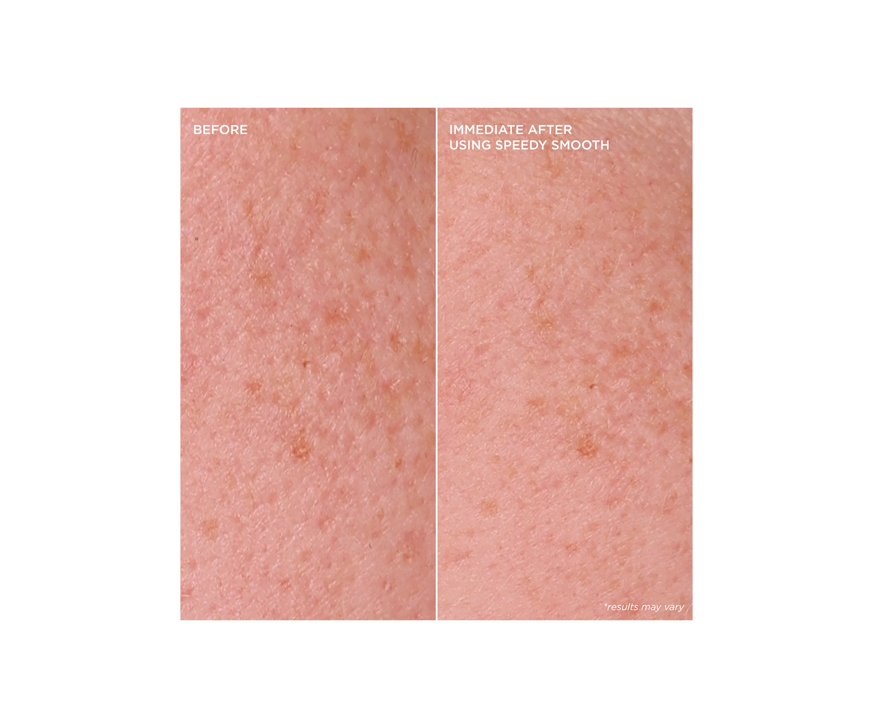 The POREfessional Speedy Smooth Pore Mask