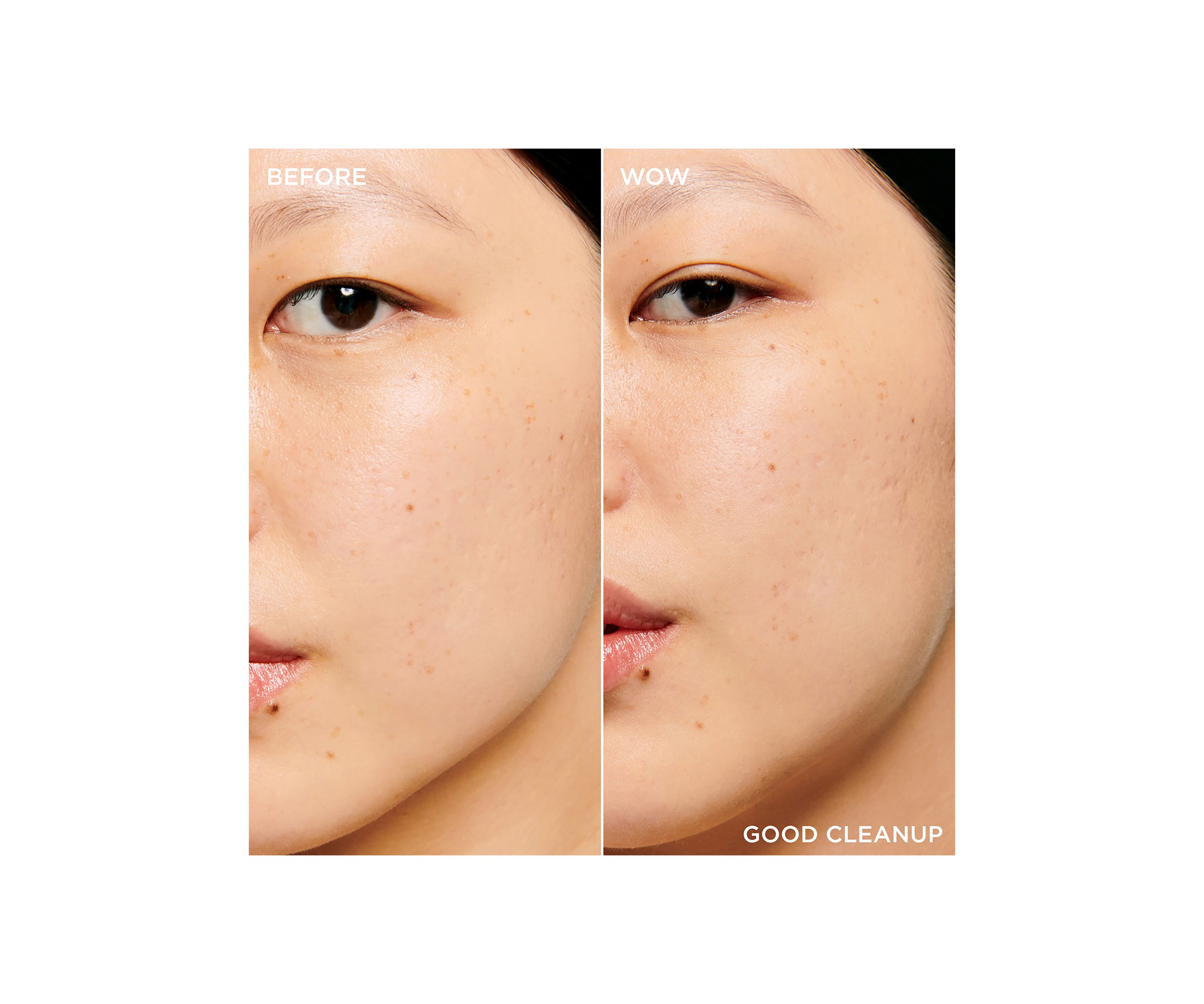 POREfessionals Pore Care Essentials Set