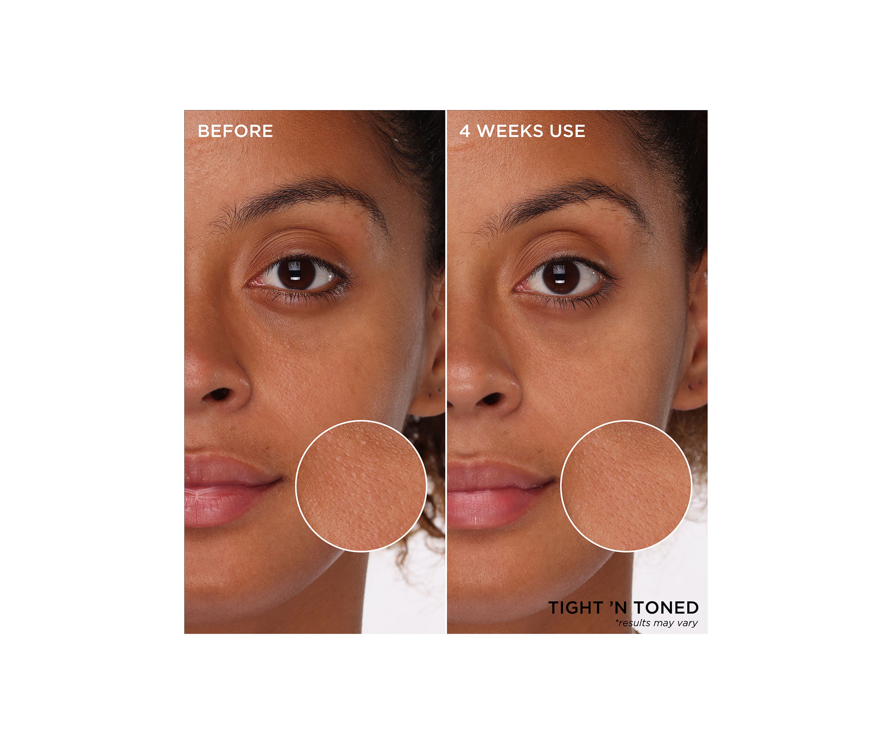 POREfessionals Pore Care Essentials Set