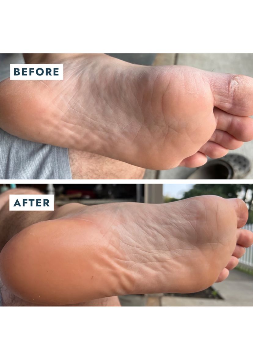 Heel Repair Duo - $23 Value!