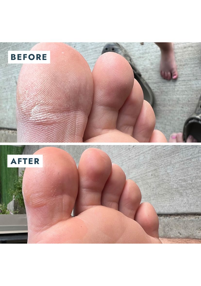 Heel Repair Duo - $23 Value!