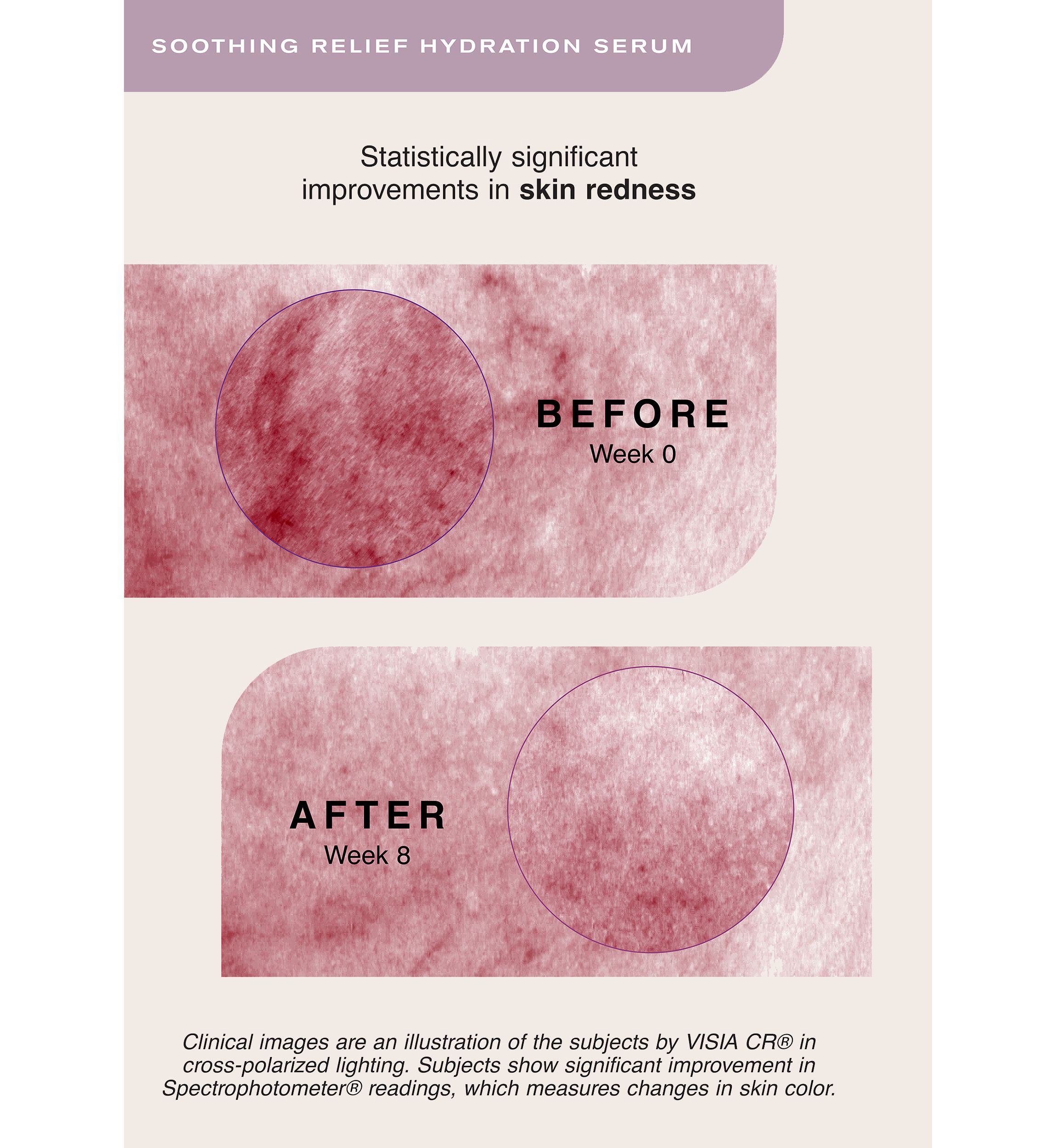 Soothing Relief Hydration Serum 