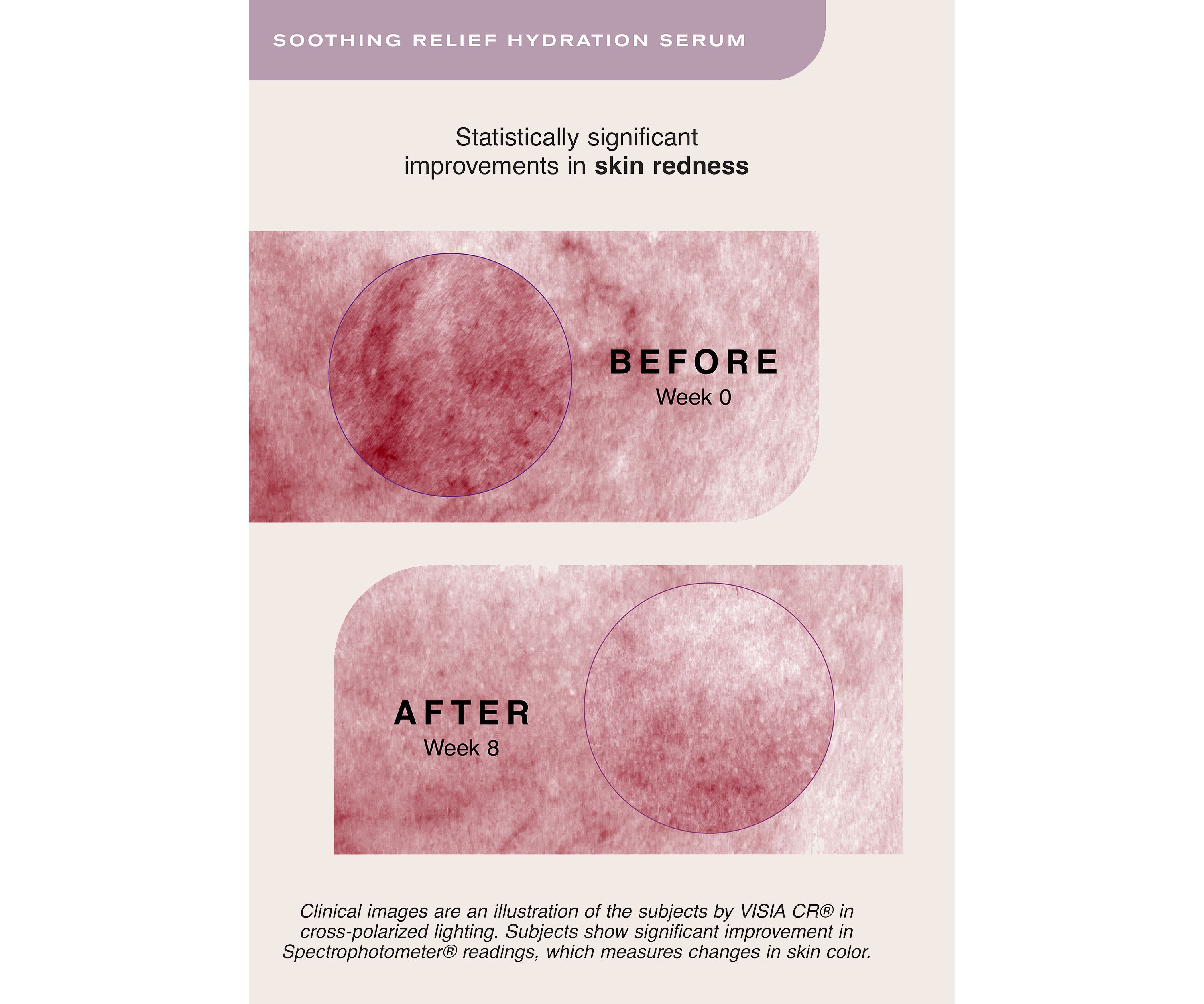 Soothing Relief Hydration Serum 